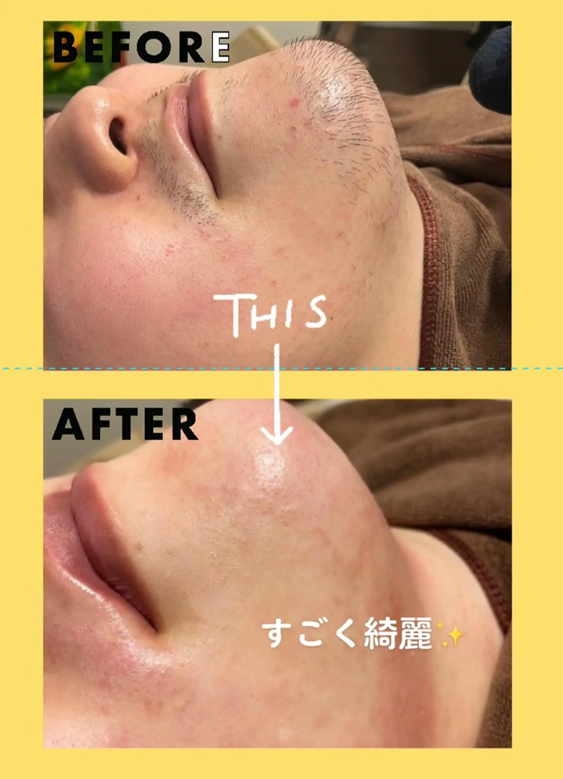 メンズ 河上★うなじや首回り Wax脱毛が得意ですのエステ・リラクイメージ