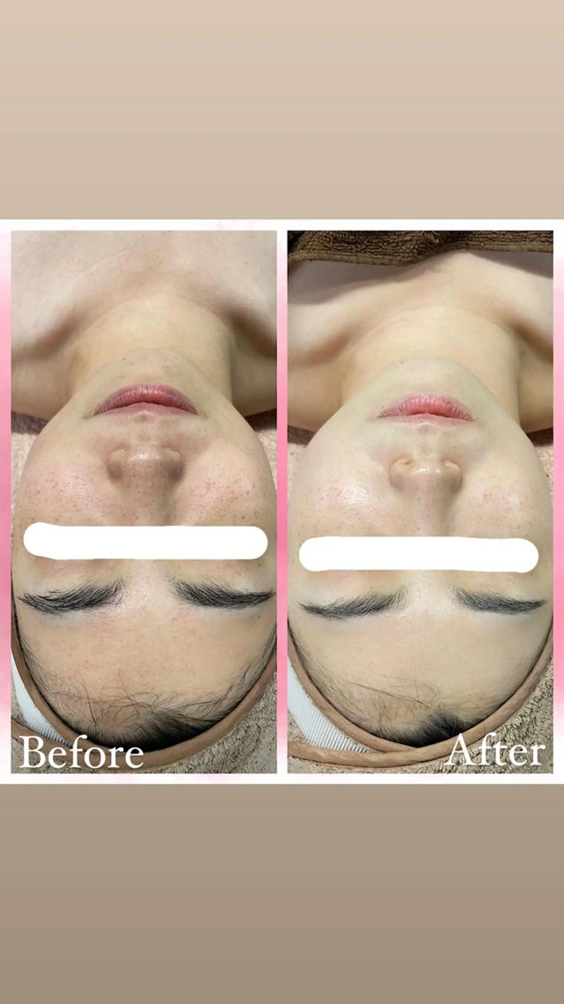 エステ salon〜RePCa〜(サロンルピカ)所属・山﨑 藍のエステ・リラクイメージ