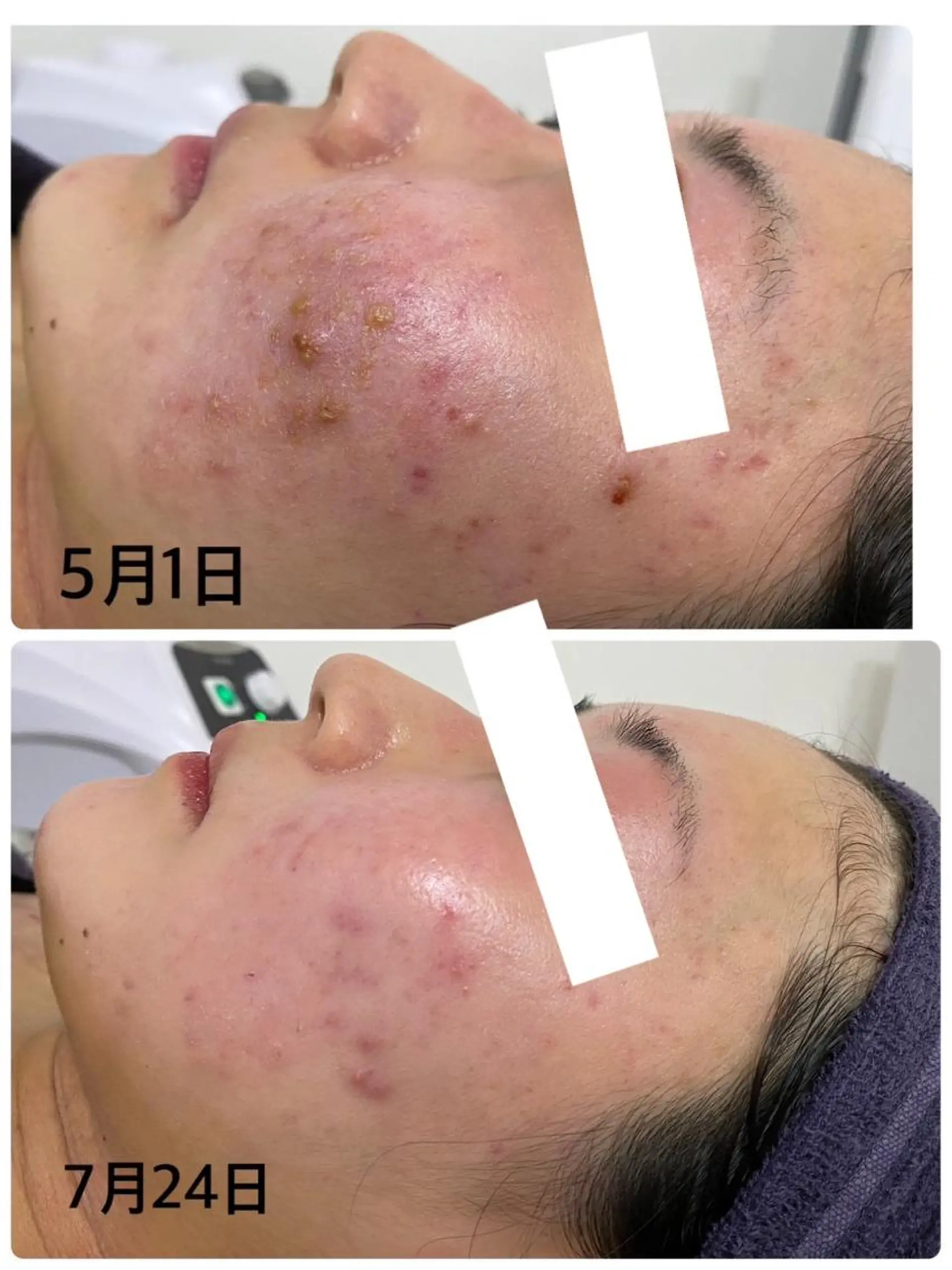 ViMORE あやのネイルデザイン