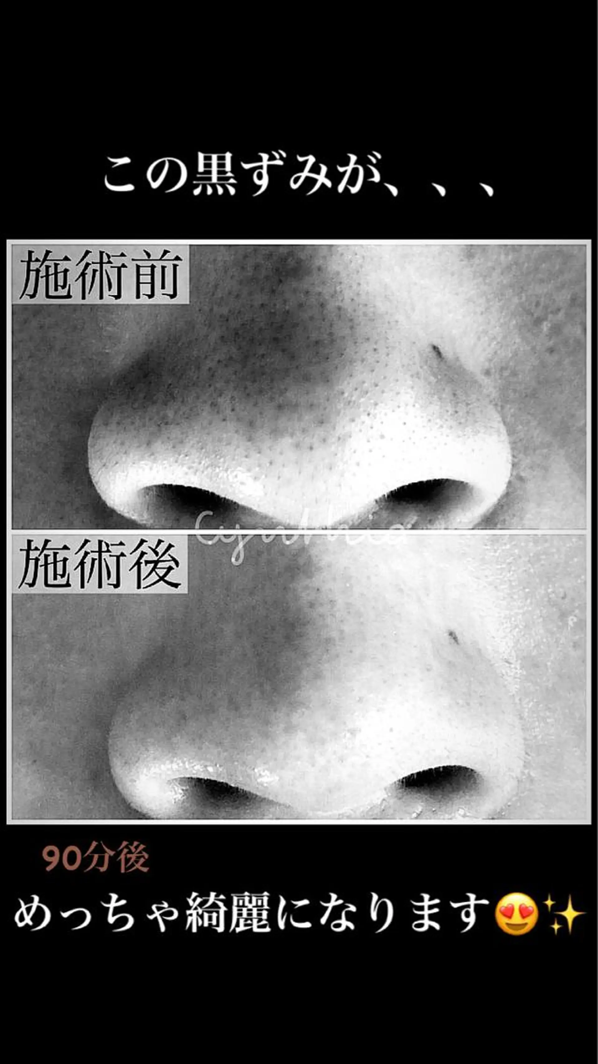 メンズ マツエク・マツパ メンズ韓国風 韓国風マツエク エステ 毛穴ケア専門店 Cynthiaのエステ・リラクイメージ