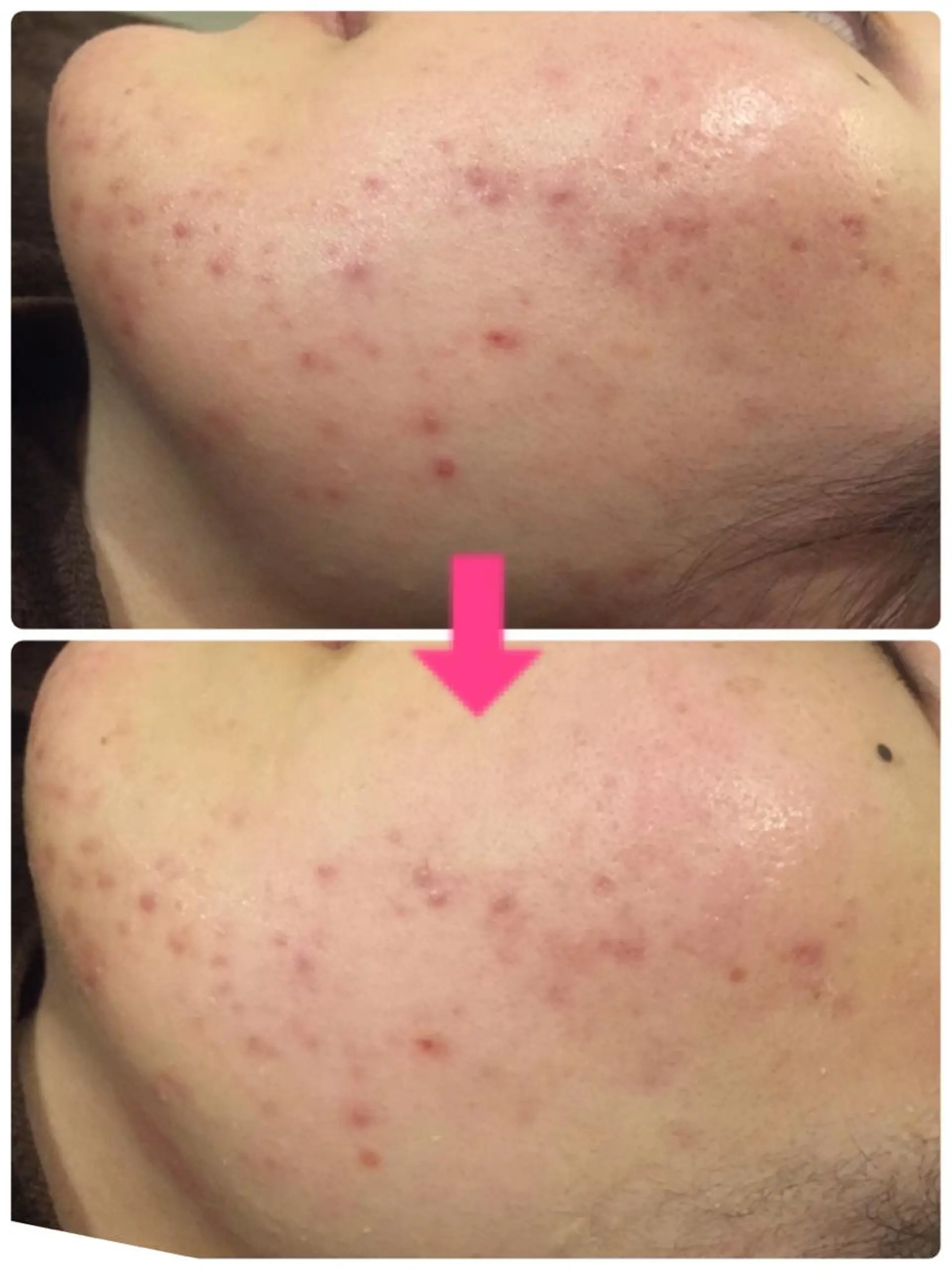 ロング カラー パーマ ヘアアレンジ メンズ キッズ ネイル マツエク・マツパ ‍痩身＆ボディ 結果出し🌟丹野のエステ・リラクイメージ