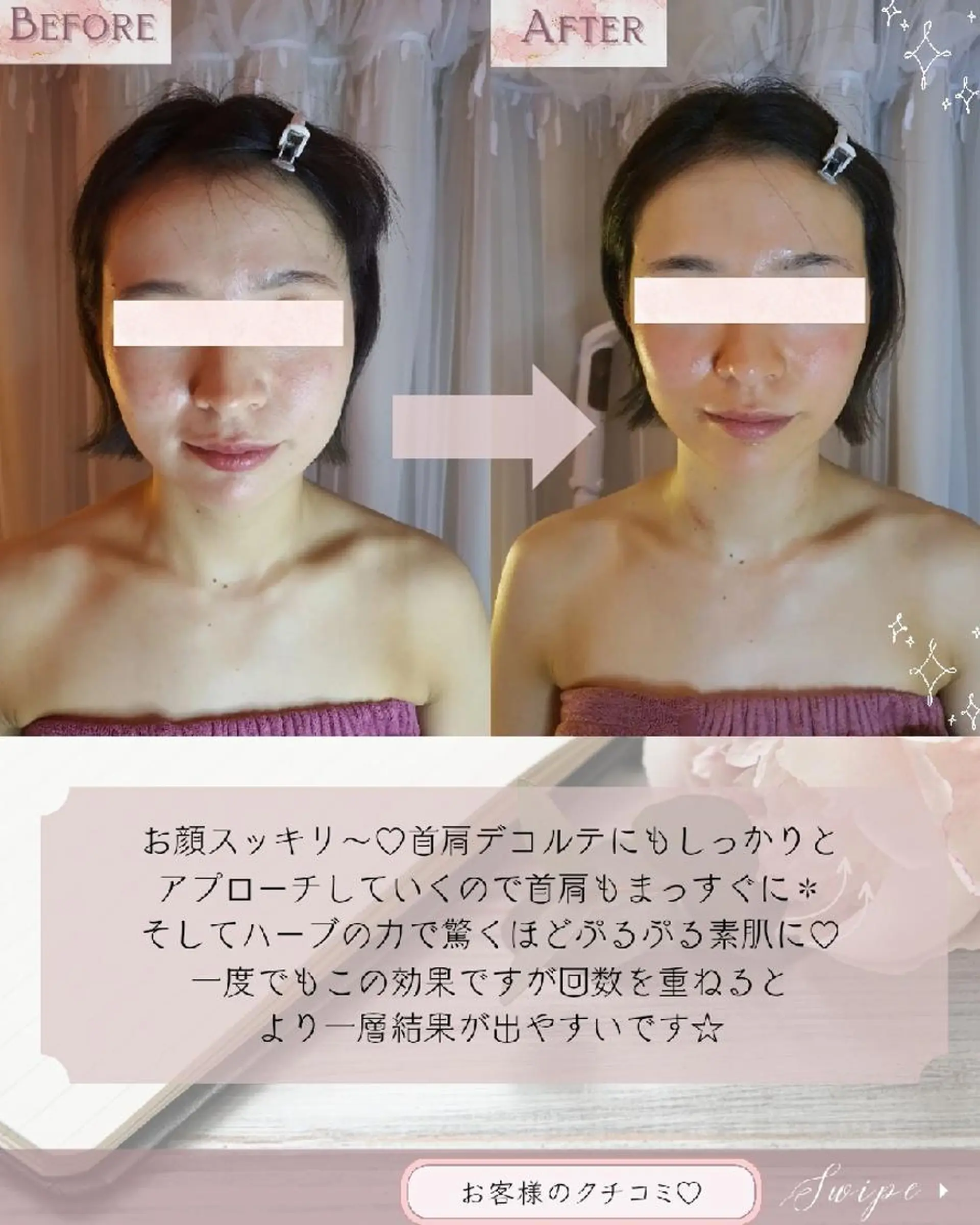 痩身ハーブピーリング 筋膜リリース☆B&Hのエステ・リラクイメージ