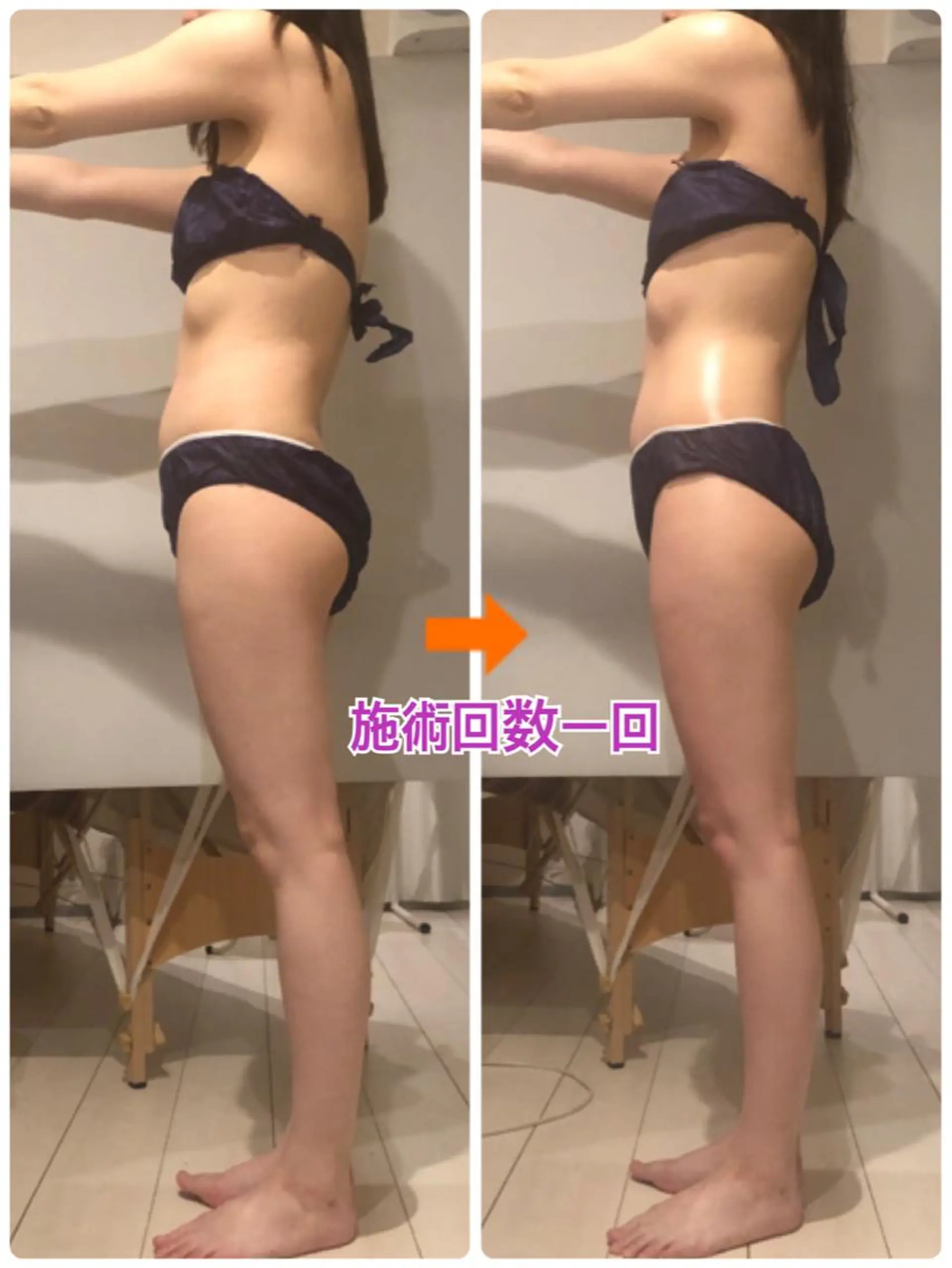 ショート カラー パーマ ヘアアレンジ メンズ キッズ ネイル マツエク・マツパ くびれヘア マットネイル 赤色 ‍痩身＆ボディ 結果出し🌟丹野のエステ・リラクイメージ