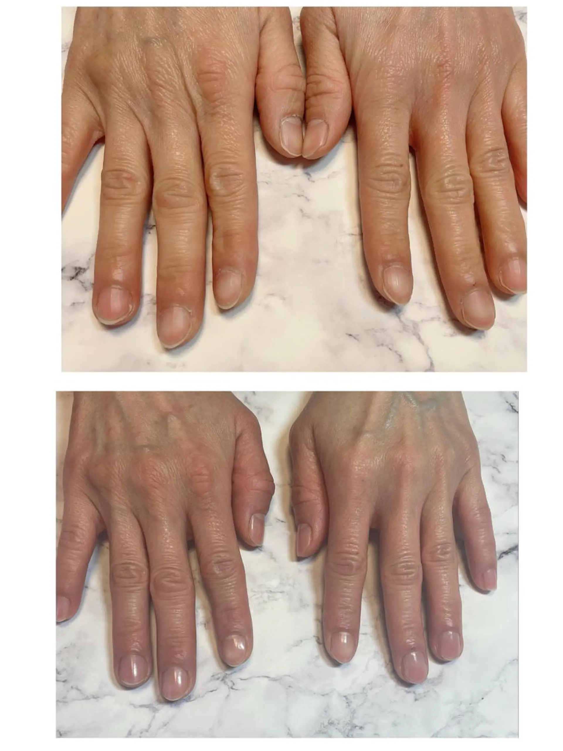 ネイル 高野 祐紀のネイルデザイン