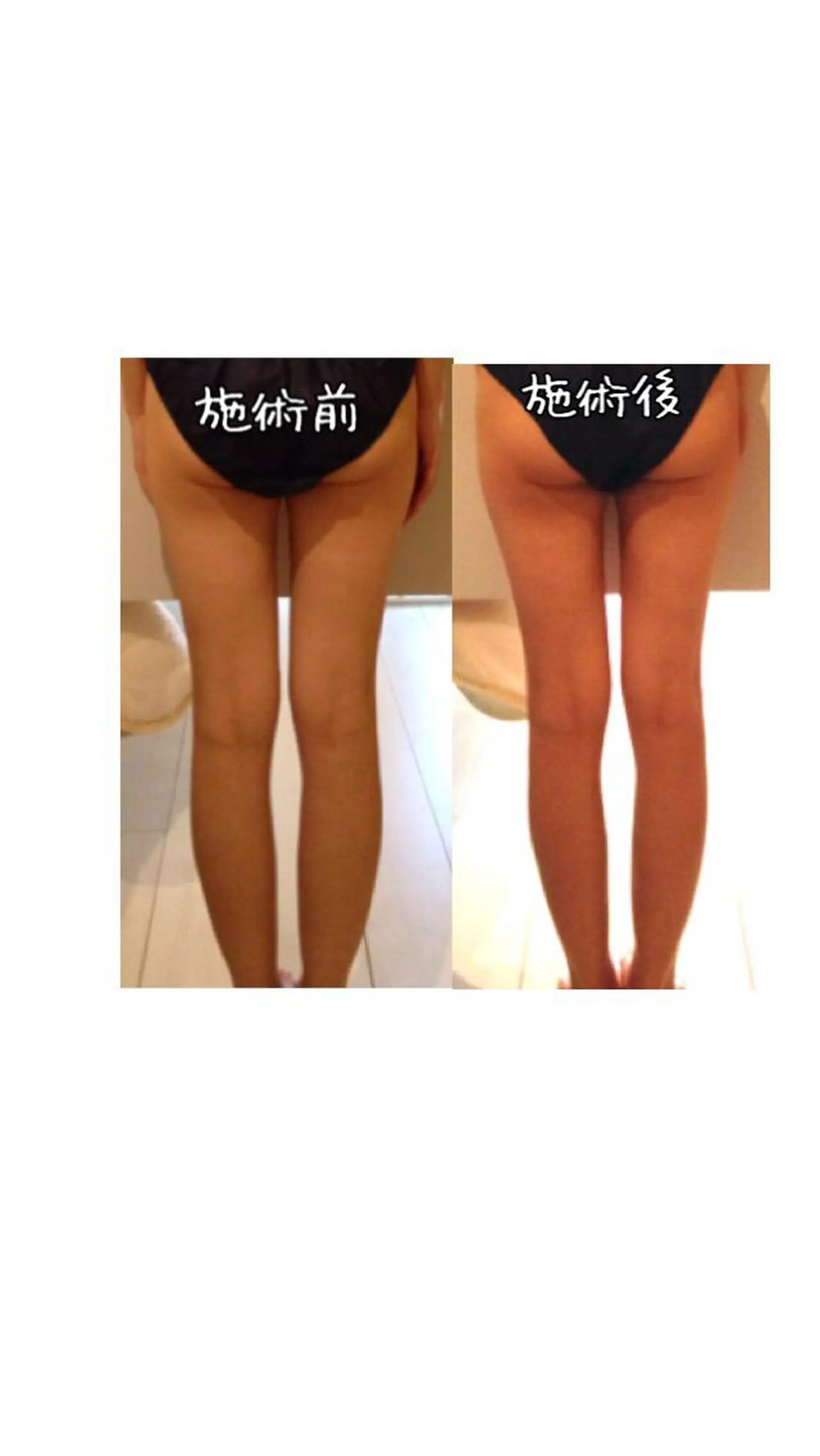 ミディアム カラー パーマ ヘアアレンジ メンズ キッズ ネイル マツエク・マツパ 強圧オールハンド痩身 片野のエステ・リラクイメージ