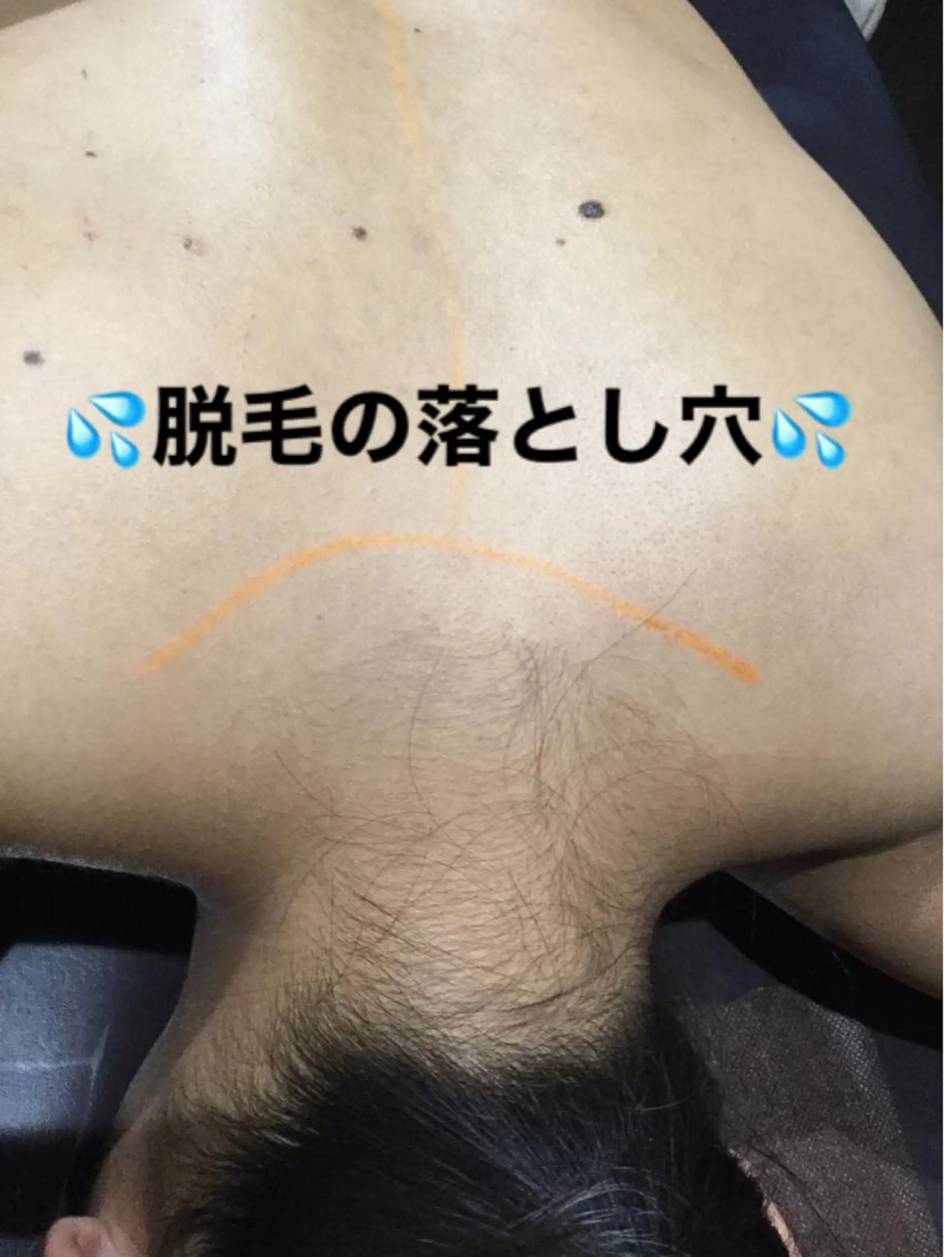 脱毛 Ange -viva la vida-所属・Ange vivalavidaのエステ・リラクイメージ