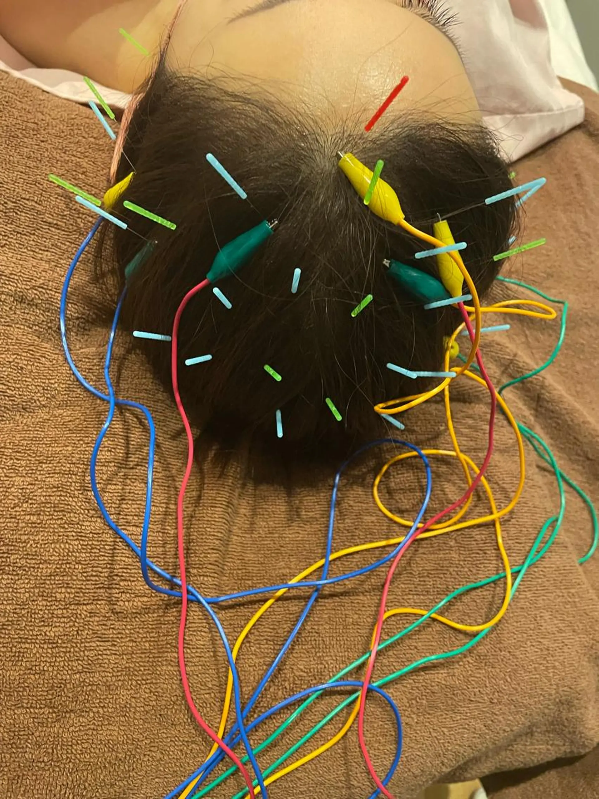 美容鍼灸サロン mahoroba院長のエステ・リラクイメージ