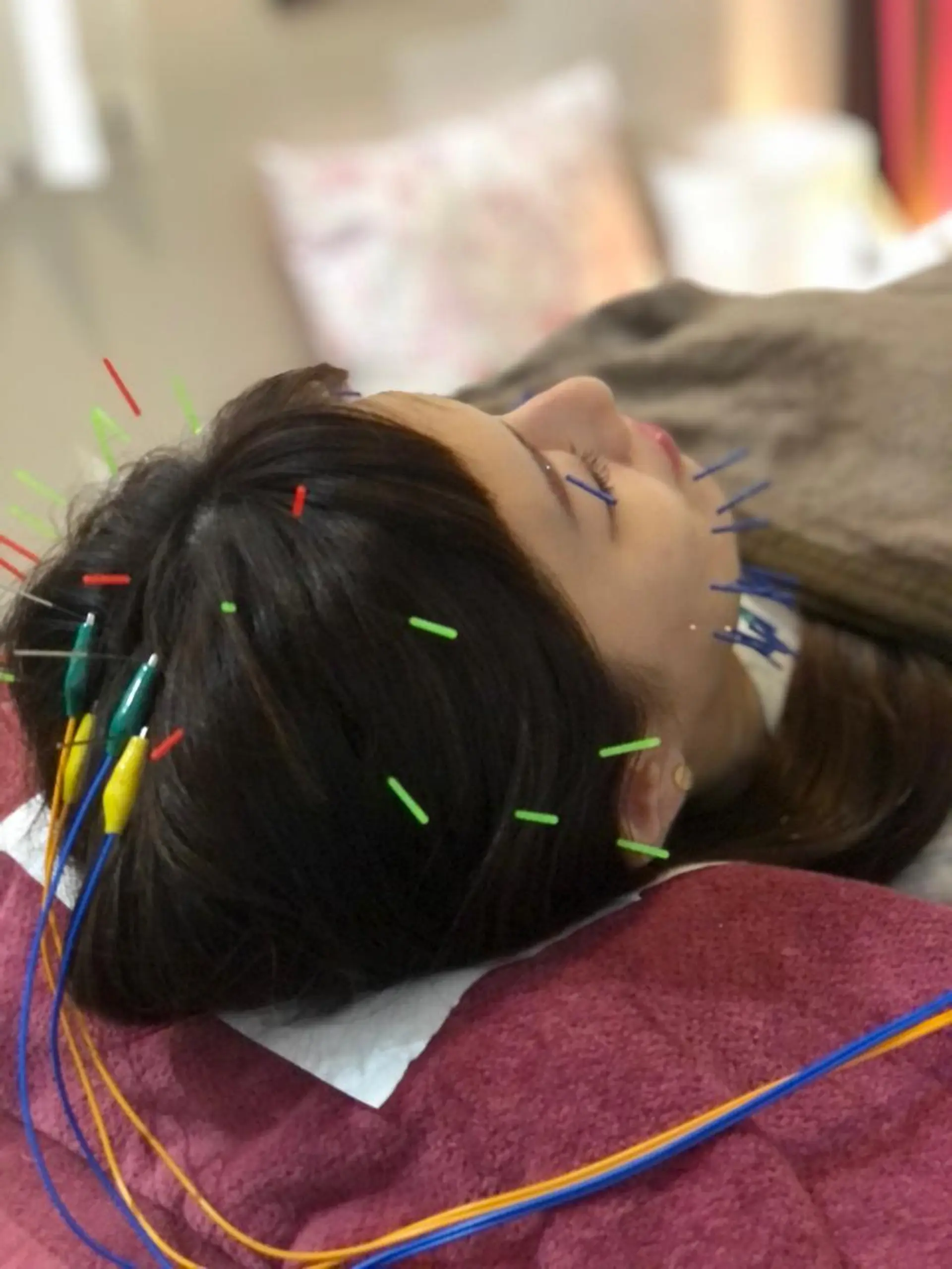 エステ リラク 美容鍼灸女性専用 りんご鍼灸治療院のその他イメージ