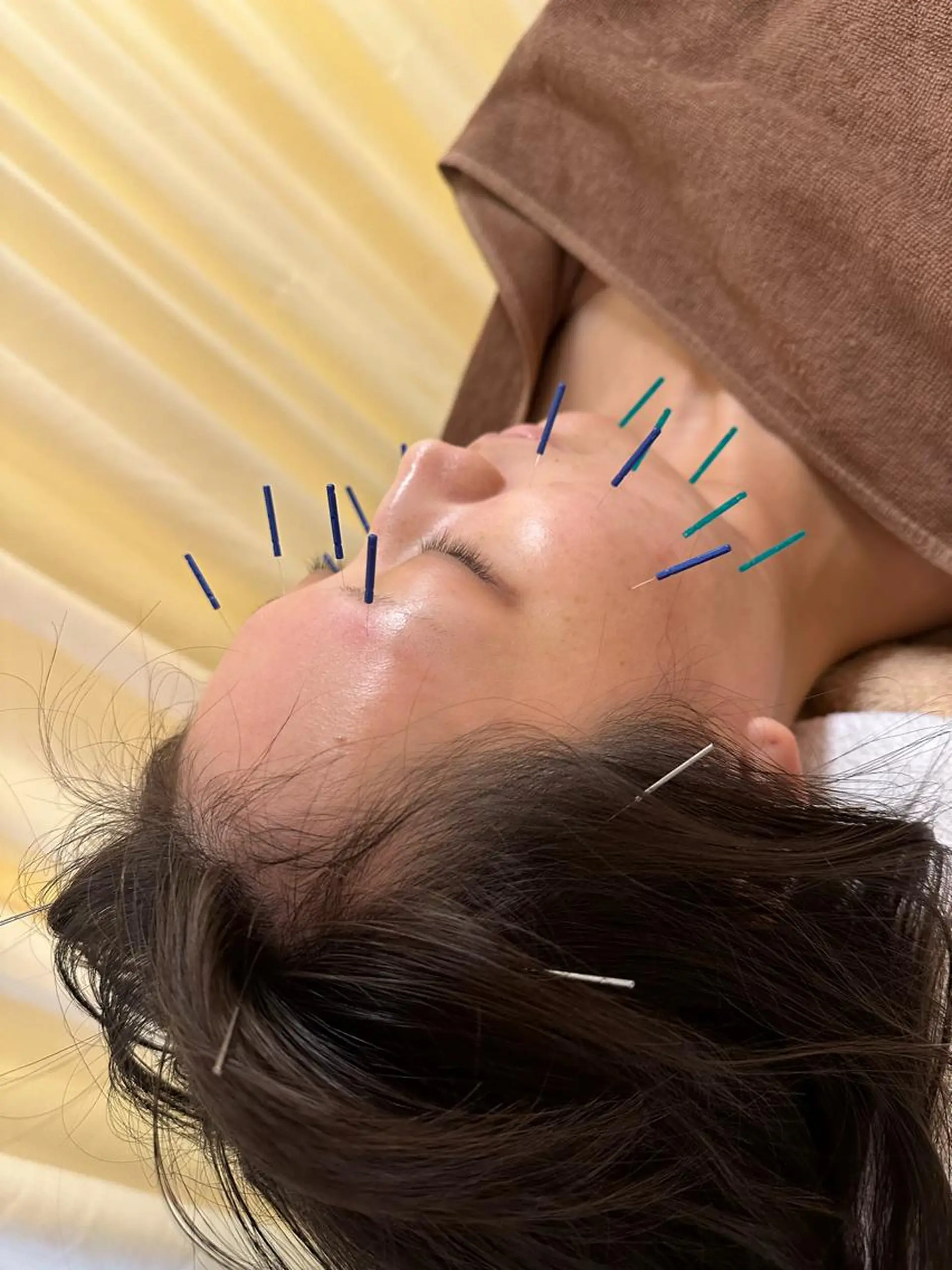 鍼灸サロン BBB3のその他イメージ