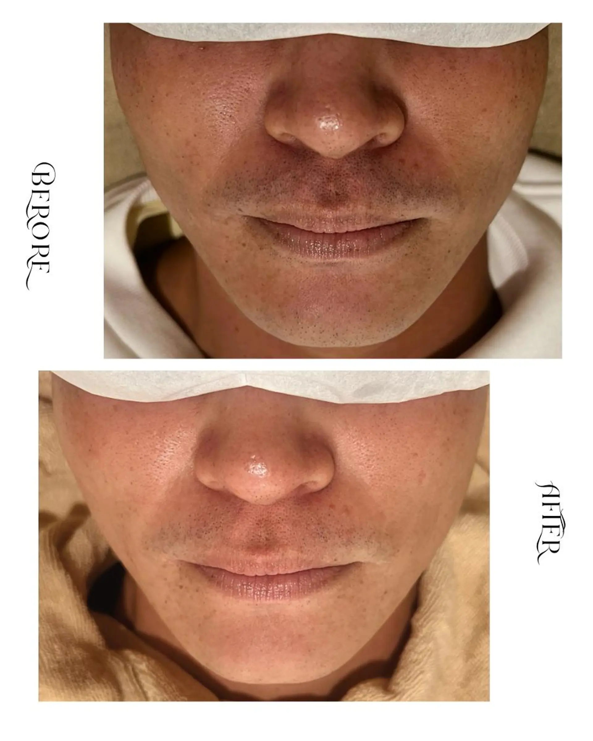 脱毛・肌質改善サロン Linoのエステ・リラクイメージ