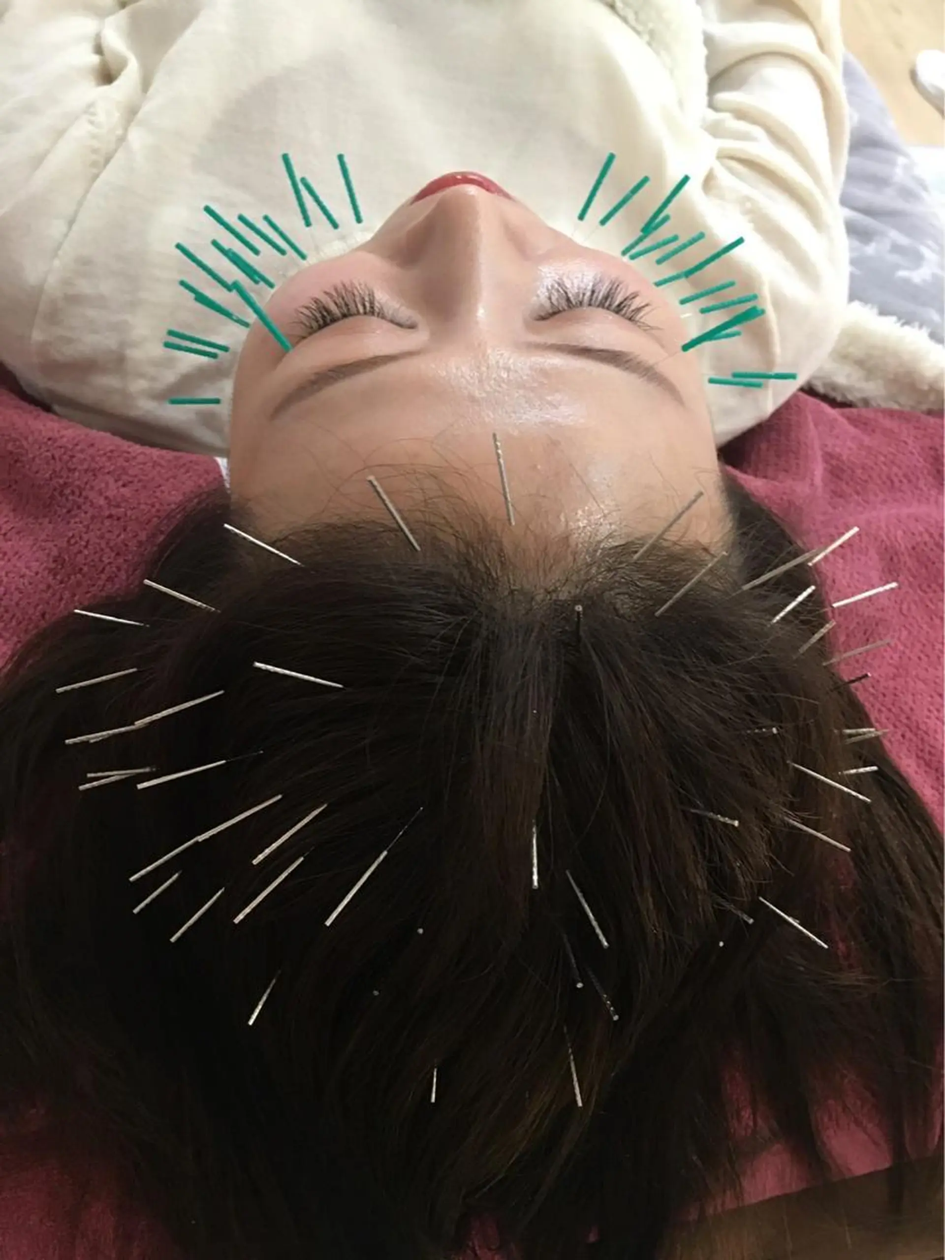 美容鍼灸女性専用 りんご鍼灸治療院のその他イメージ