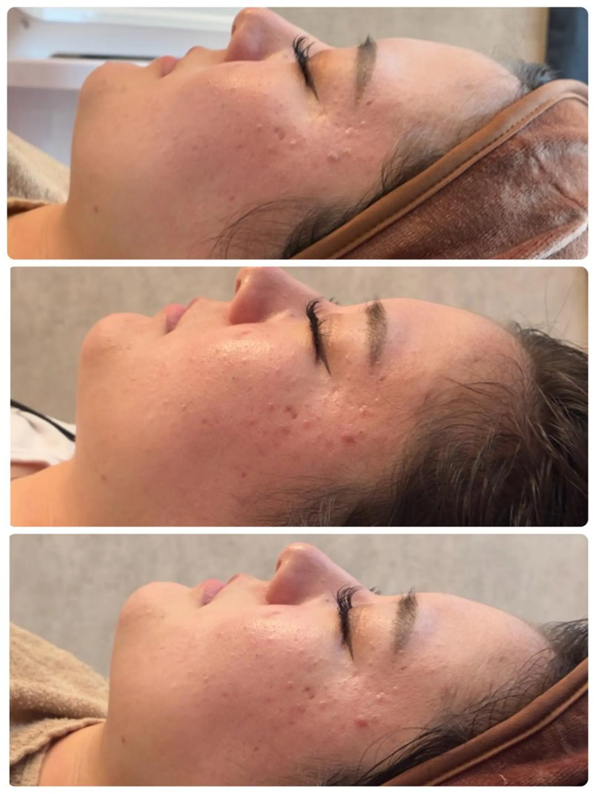 FLEURフェイシャ ル🫧ハーブ🌿小顔のエステ・リラクイメージ