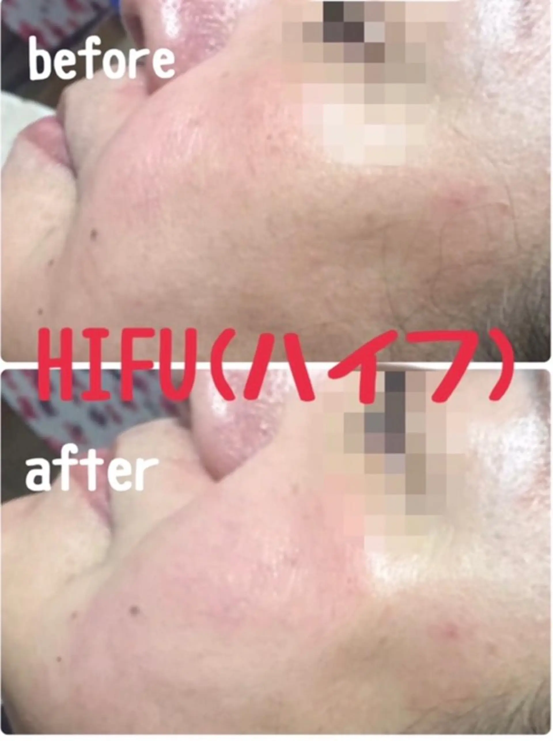 肌質改善サロンChouChou所属・肌質改善サロン chouchouのエステ・リラクイメージ