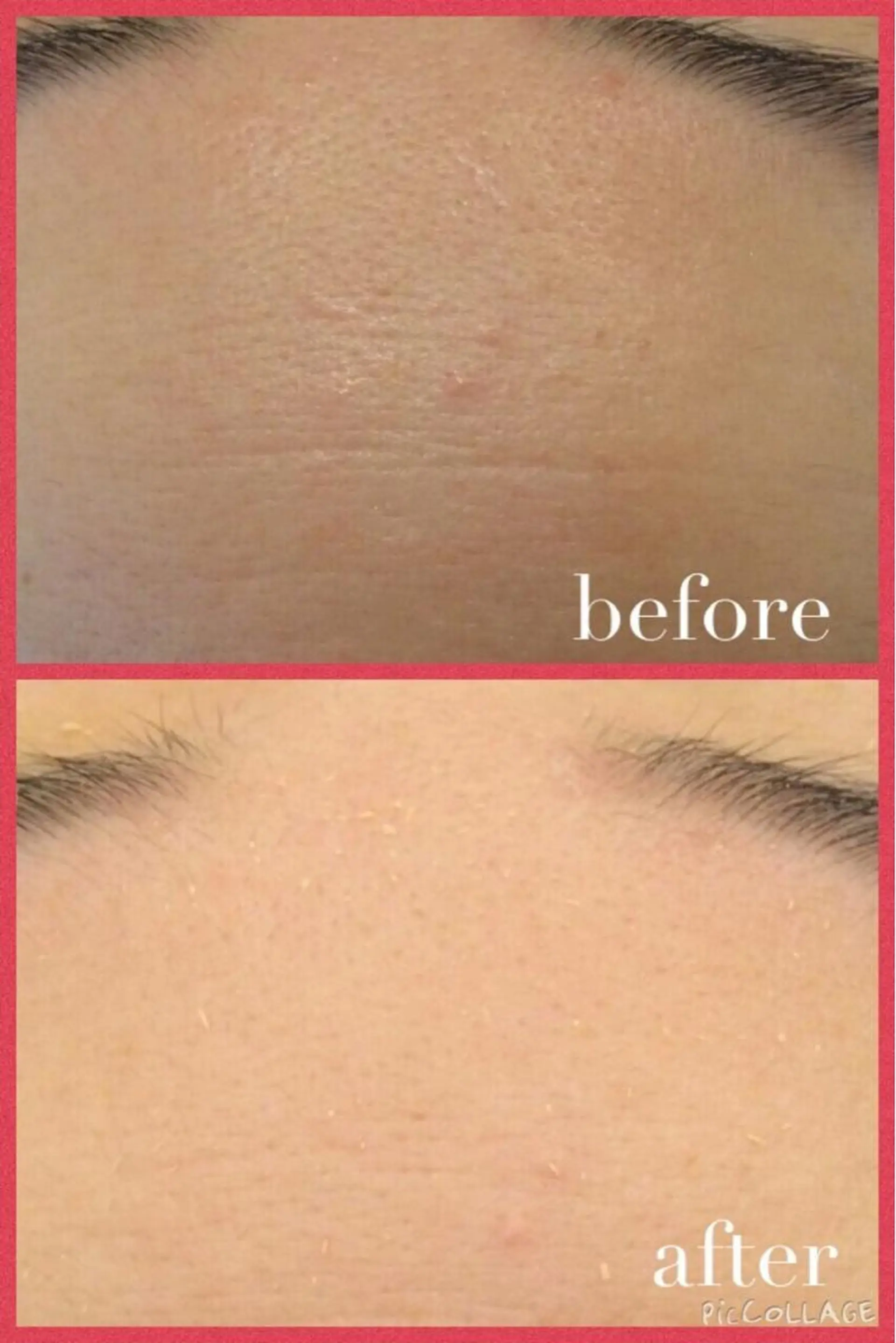 メンズ 金の糸脱毛 産毛ケア専門のエステ・リラクイメージ