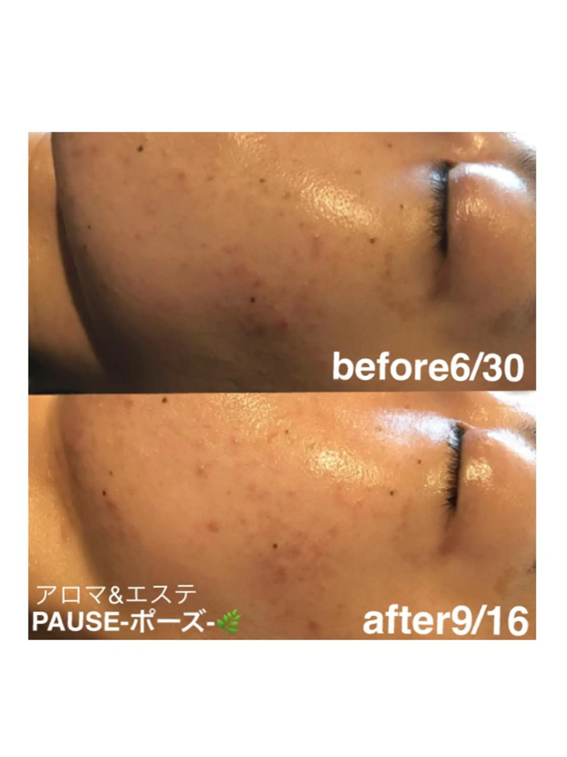 エステ 浜野 恵美のエステ・リラクイメージ