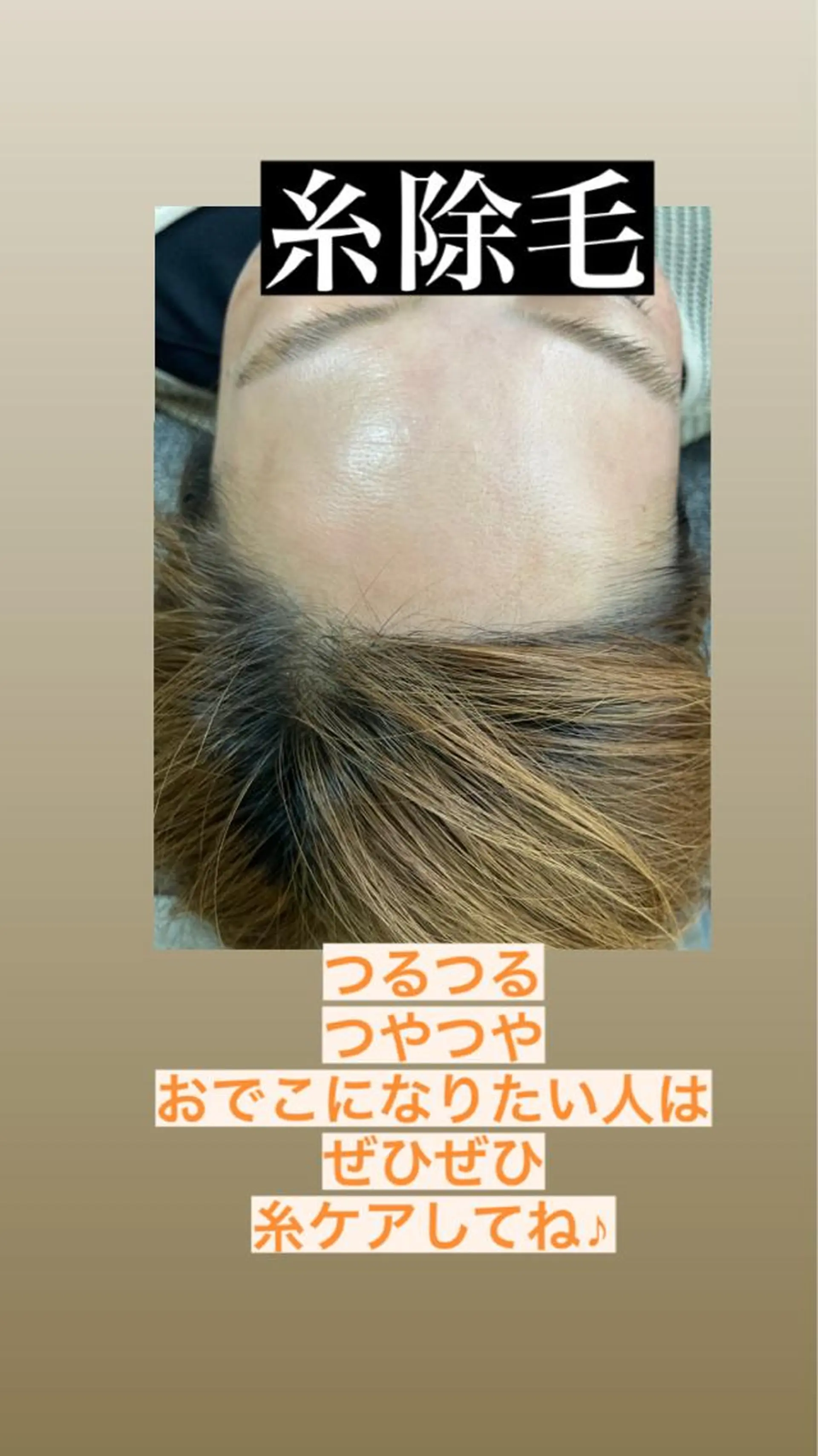 エステ 産毛専門店 Bittoのエステ・リラクイメージ