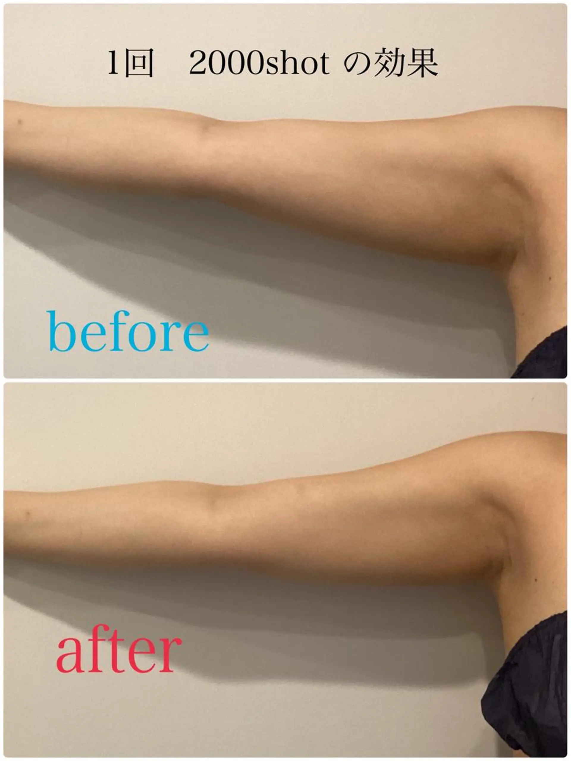 エステ 【医療提携エステ】 痩身専門Soinのエステ・リラクイメージ