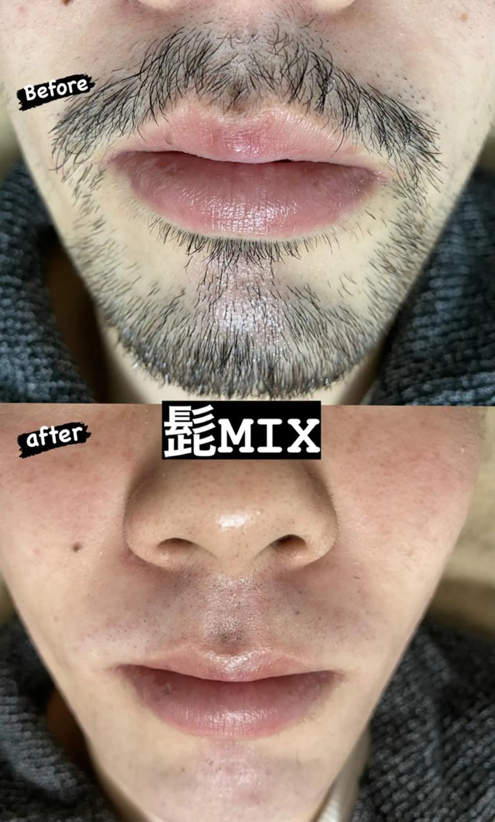 メンズ 脱毛 Epina 千葉店 【エピナ】のエステ・リラクイメージ