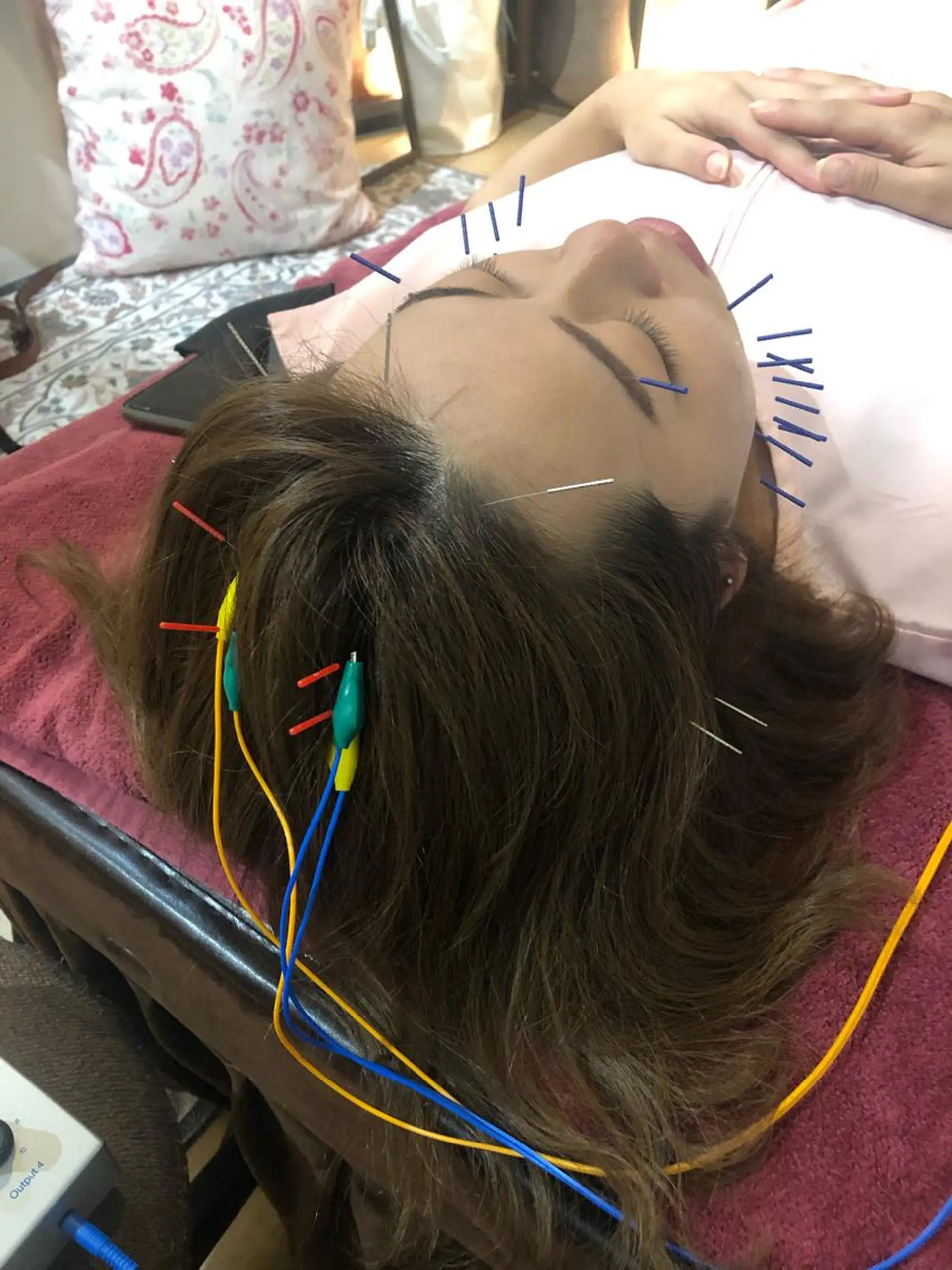 エステ リラク 美容鍼灸女性専用 りんご鍼灸治療院のその他イメージ