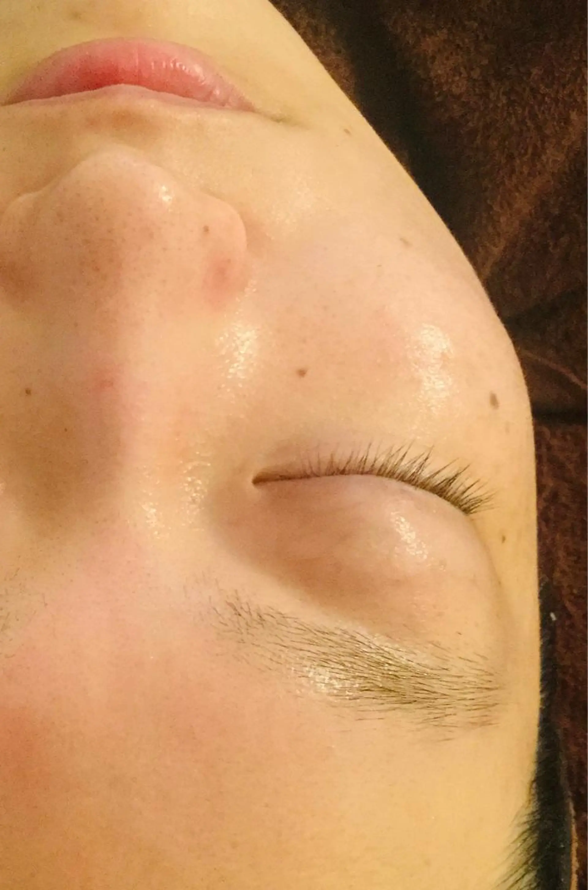 エステ リラク ニキビ/肌質改善専門 Snow skinのエステ・リラクイメージ