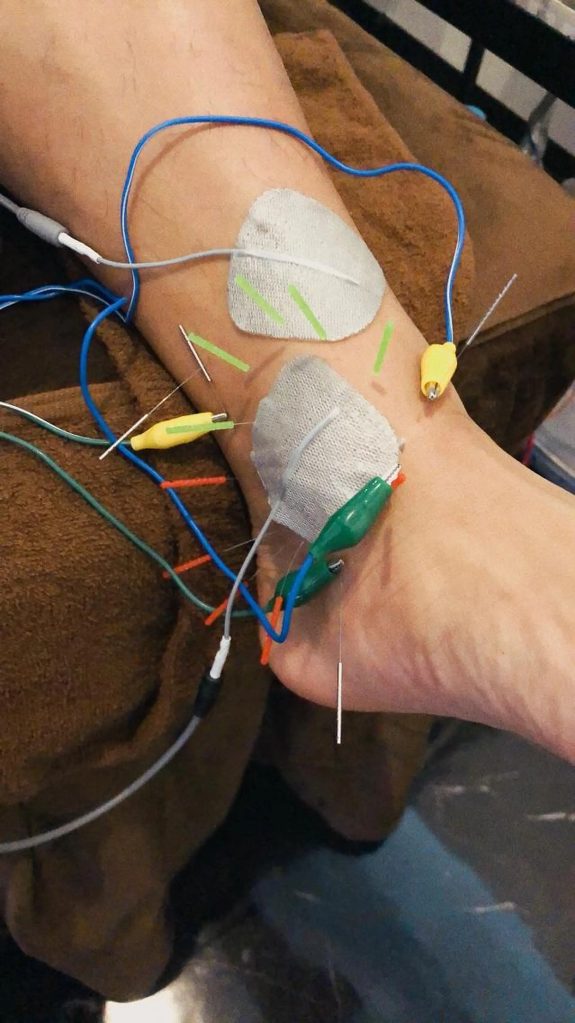 小顔矯/美容鍼/鍼灸 BeauJuのその他イメージ