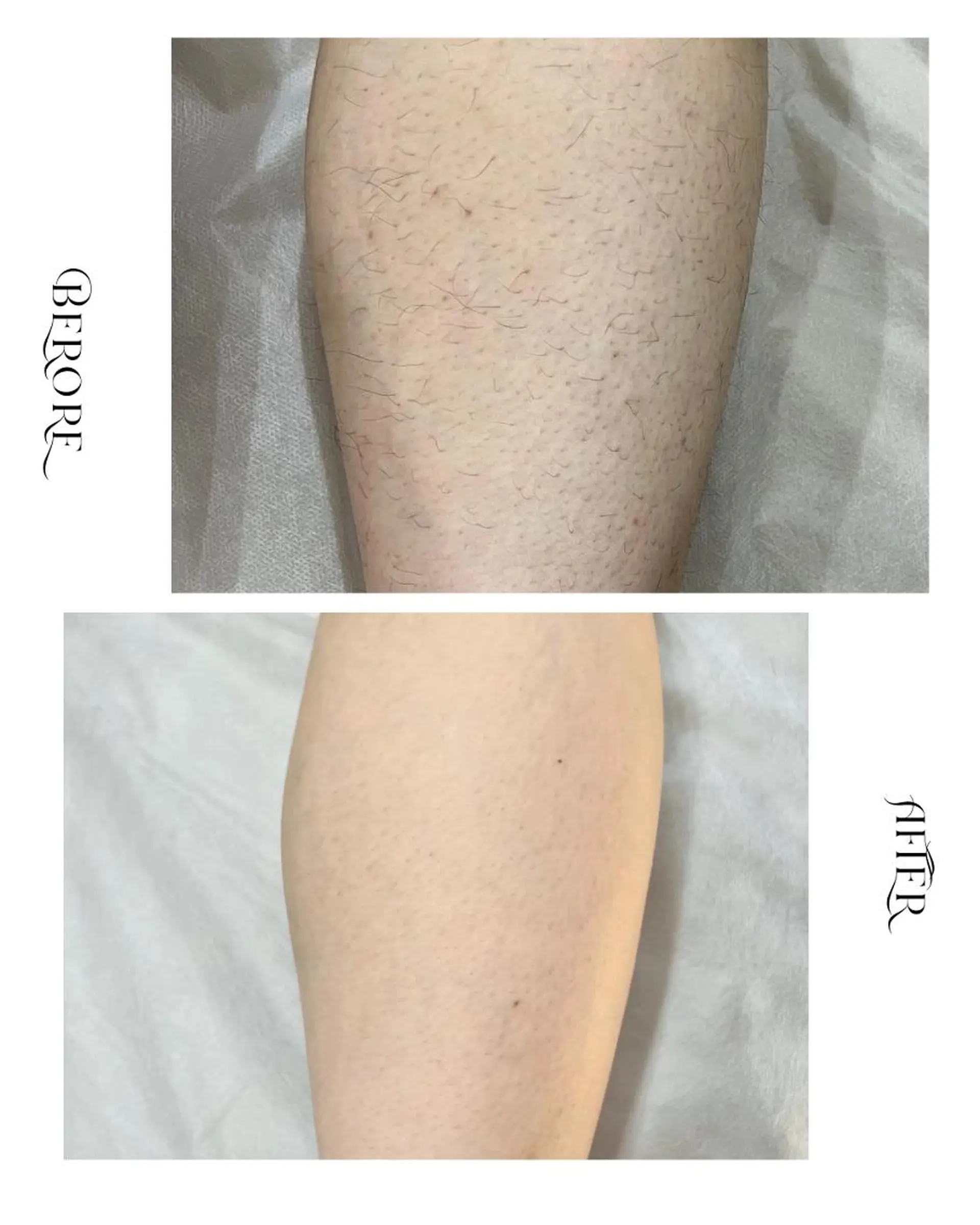 脱毛・肌質改善サロン Linoのエステ・リラクイメージ