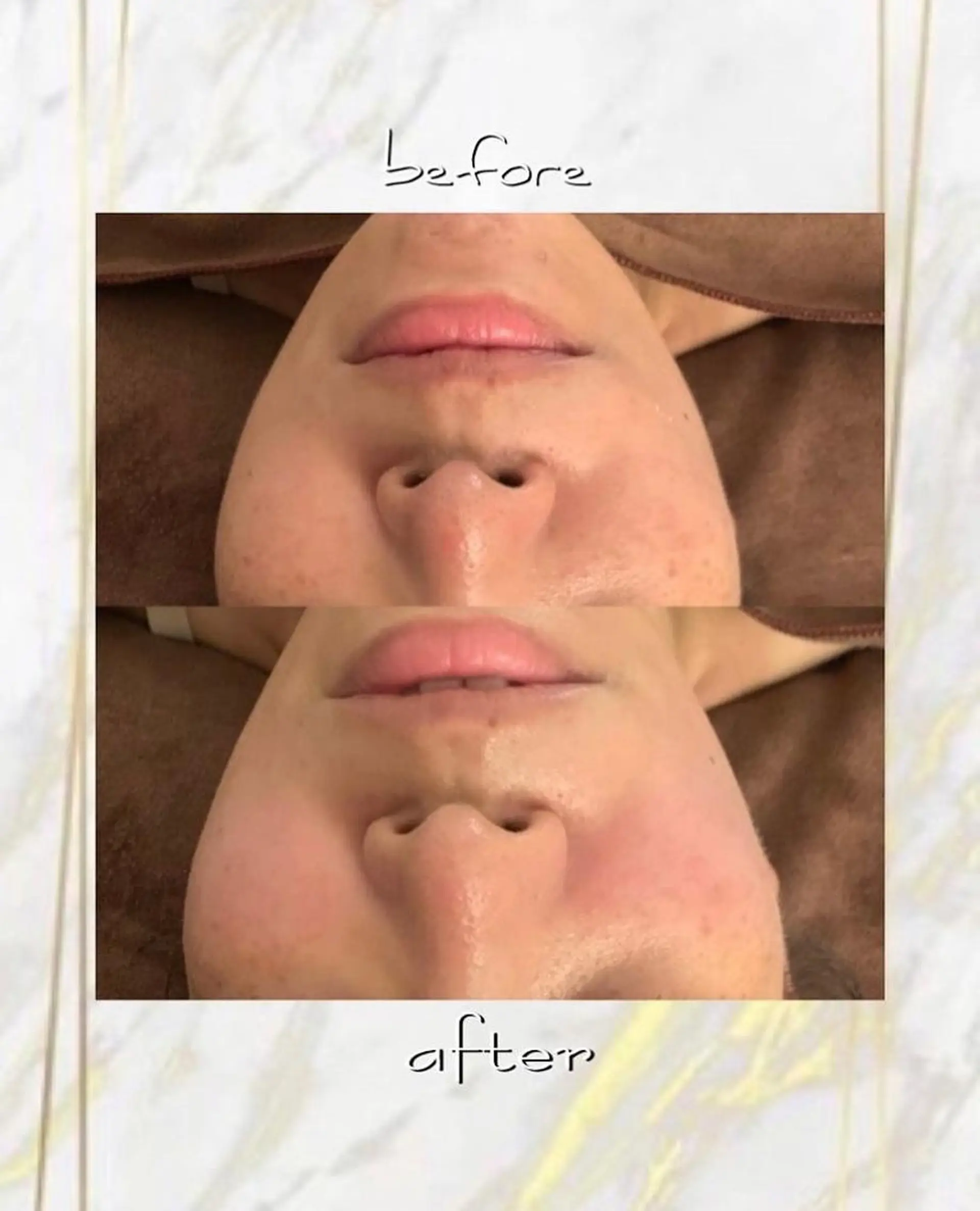 ハーブピーリング特選 認定rebirthのエステ・リラクイメージ