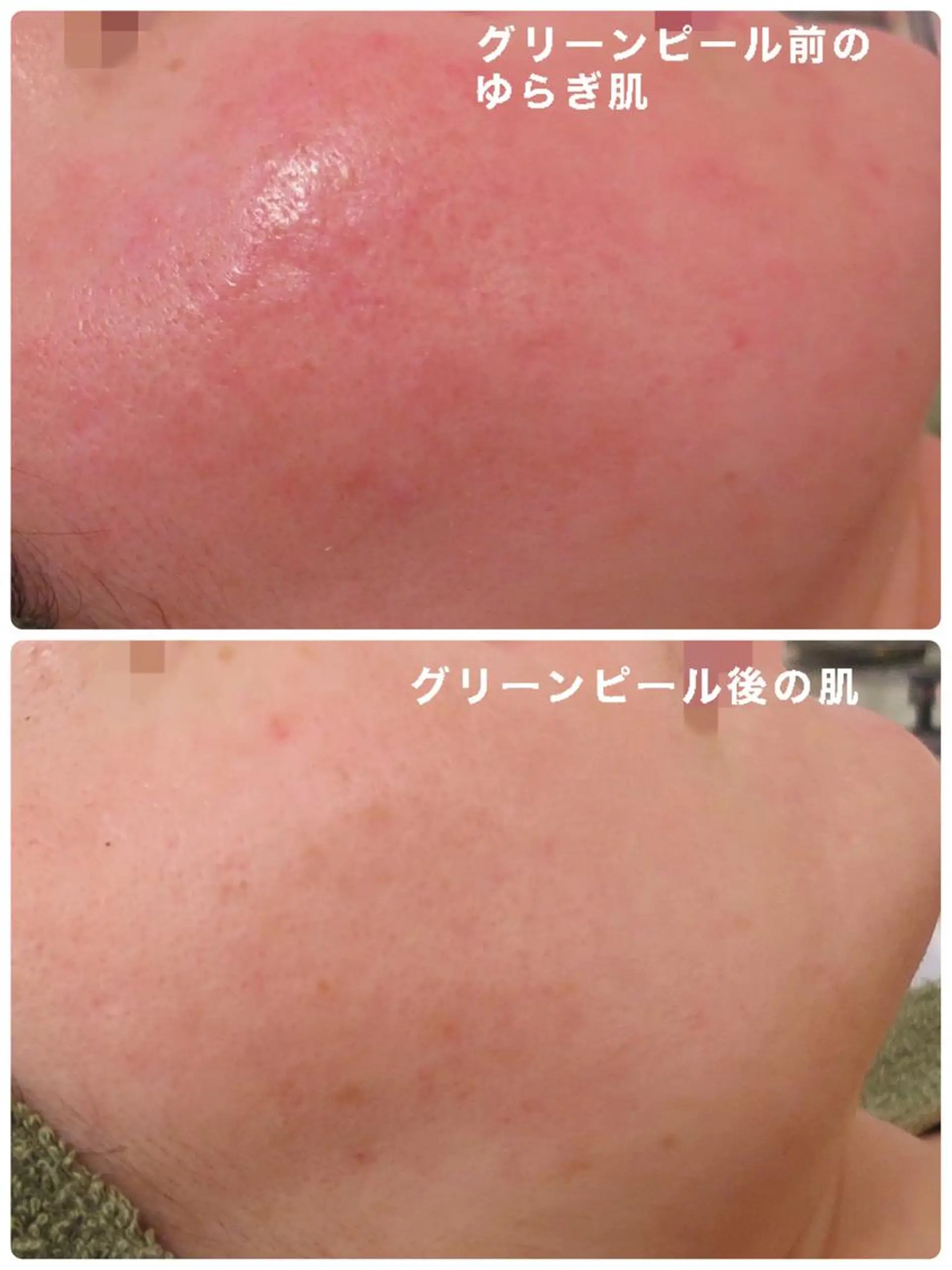 鈴木 さくらのエステ・リラクイメージ