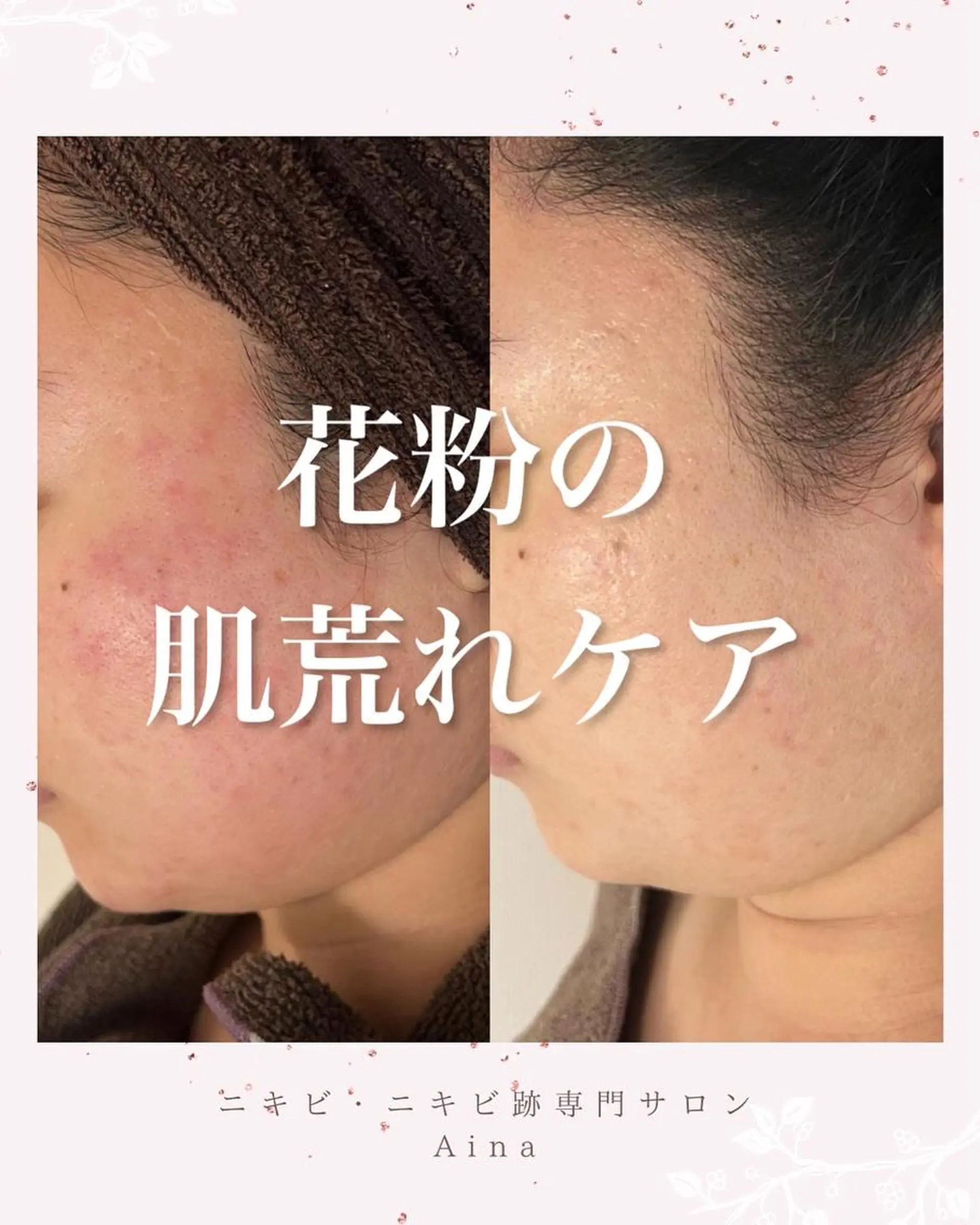 ロング パーマ ヘアアレンジ メンズ キッズ ネイル マツエク・マツパ アイブロウ 赤色 春ネイル ニキビ跡専門サロン Ａｉｎａのエステ・リラクイメージ