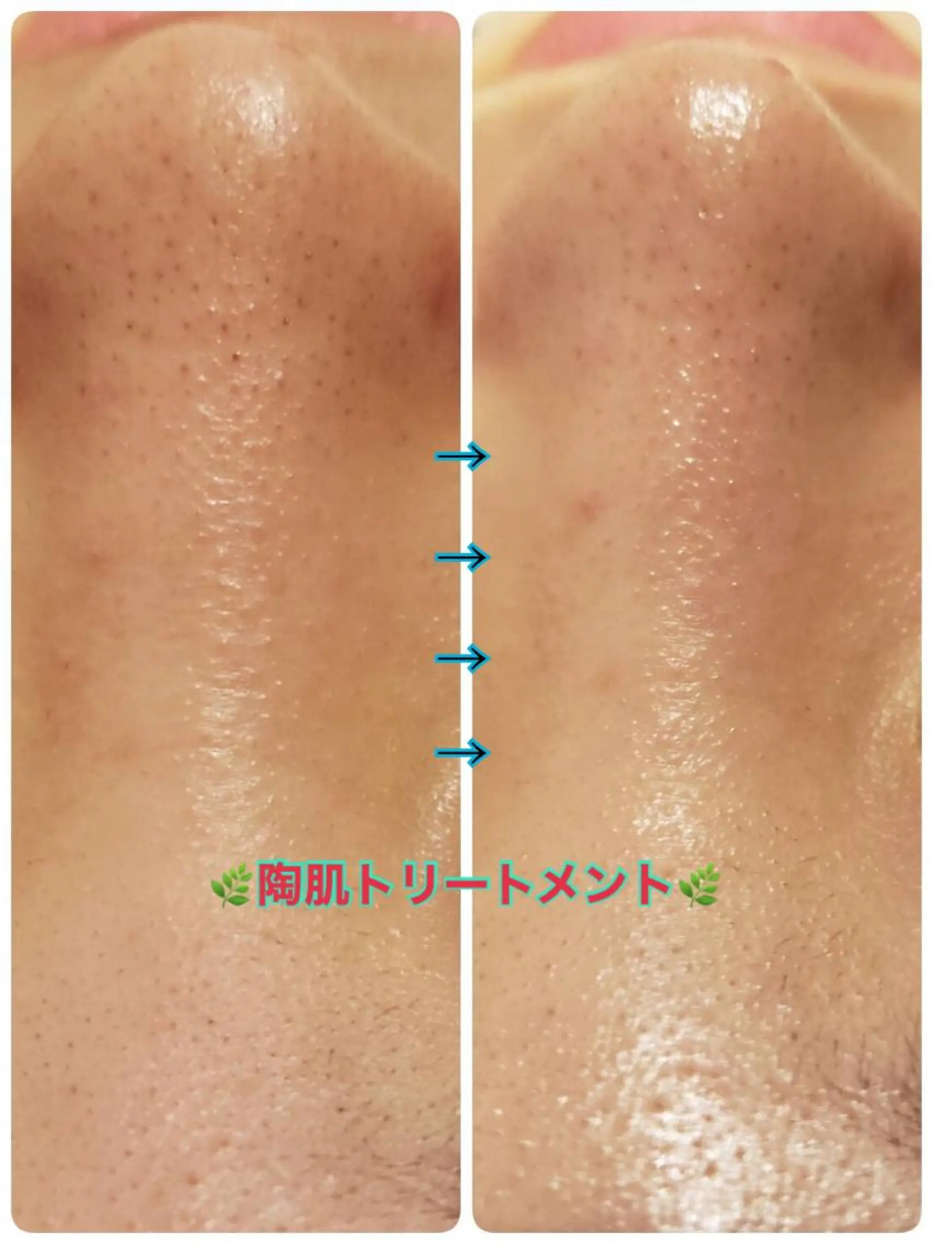 エステ Dione 立川店のエステ・リラクイメージ