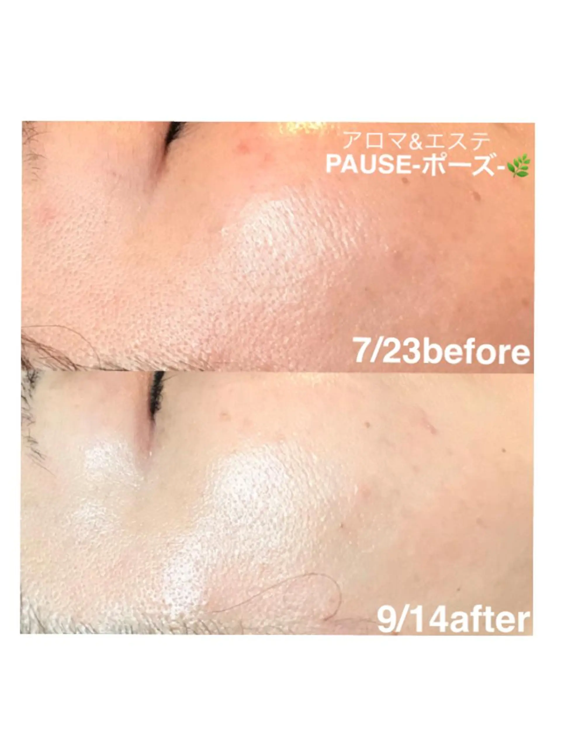 エステ 浜野 恵美のエステ・リラクイメージ