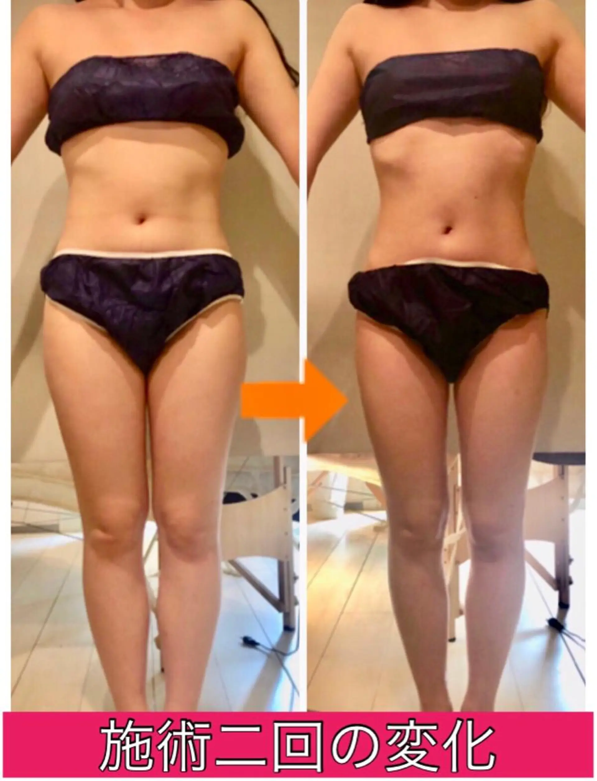 ロング カラー パーマ ヘアアレンジ メンズ キッズ ネイル マツエク・マツパ ‍痩身＆ボディ 結果出し🌟丹野のエステ・リラクイメージ