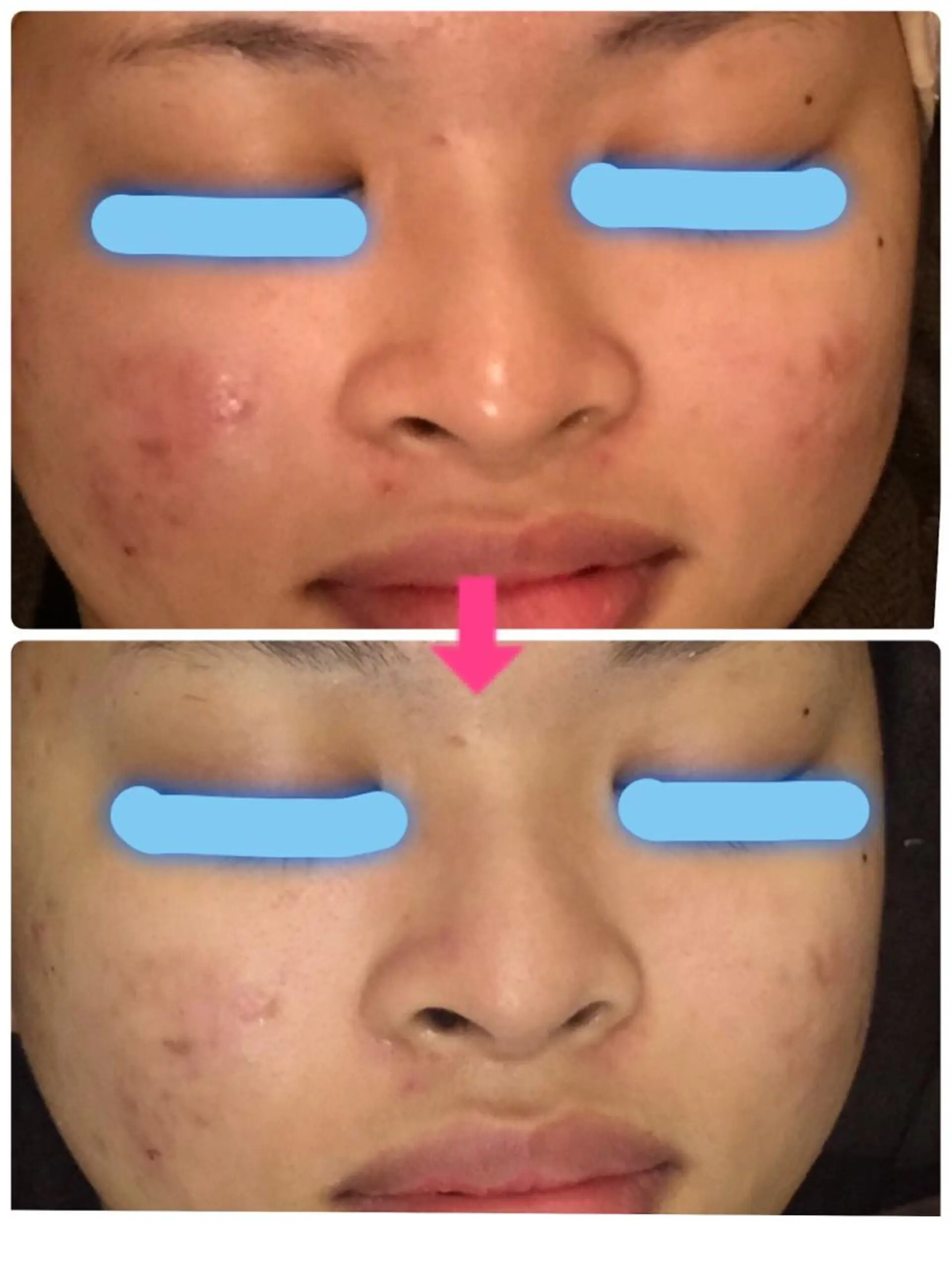 ショート カラー パーマ ヘアアレンジ メンズ キッズ ネイル マツエク・マツパ ‍痩身＆ボディ 結果出し🌟丹野のエステ・リラクイメージ