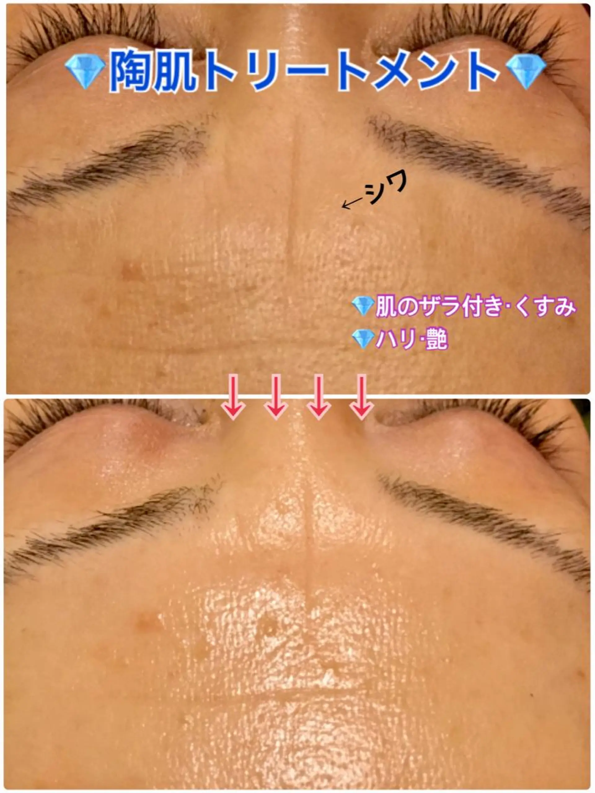 エステ Dione 立川店のエステ・リラクイメージ