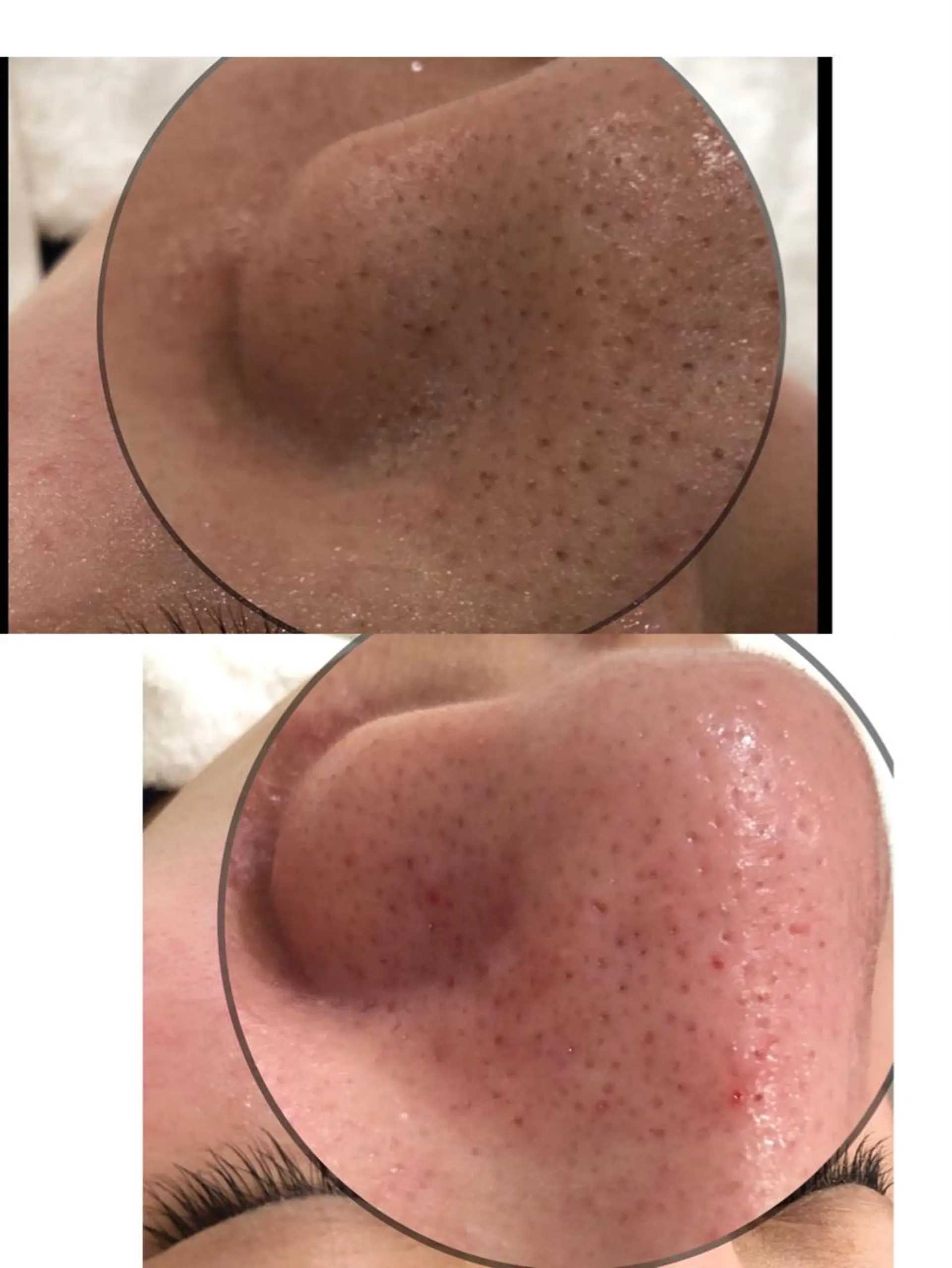 Angela エステサロンのマツエク・マツパデザイン