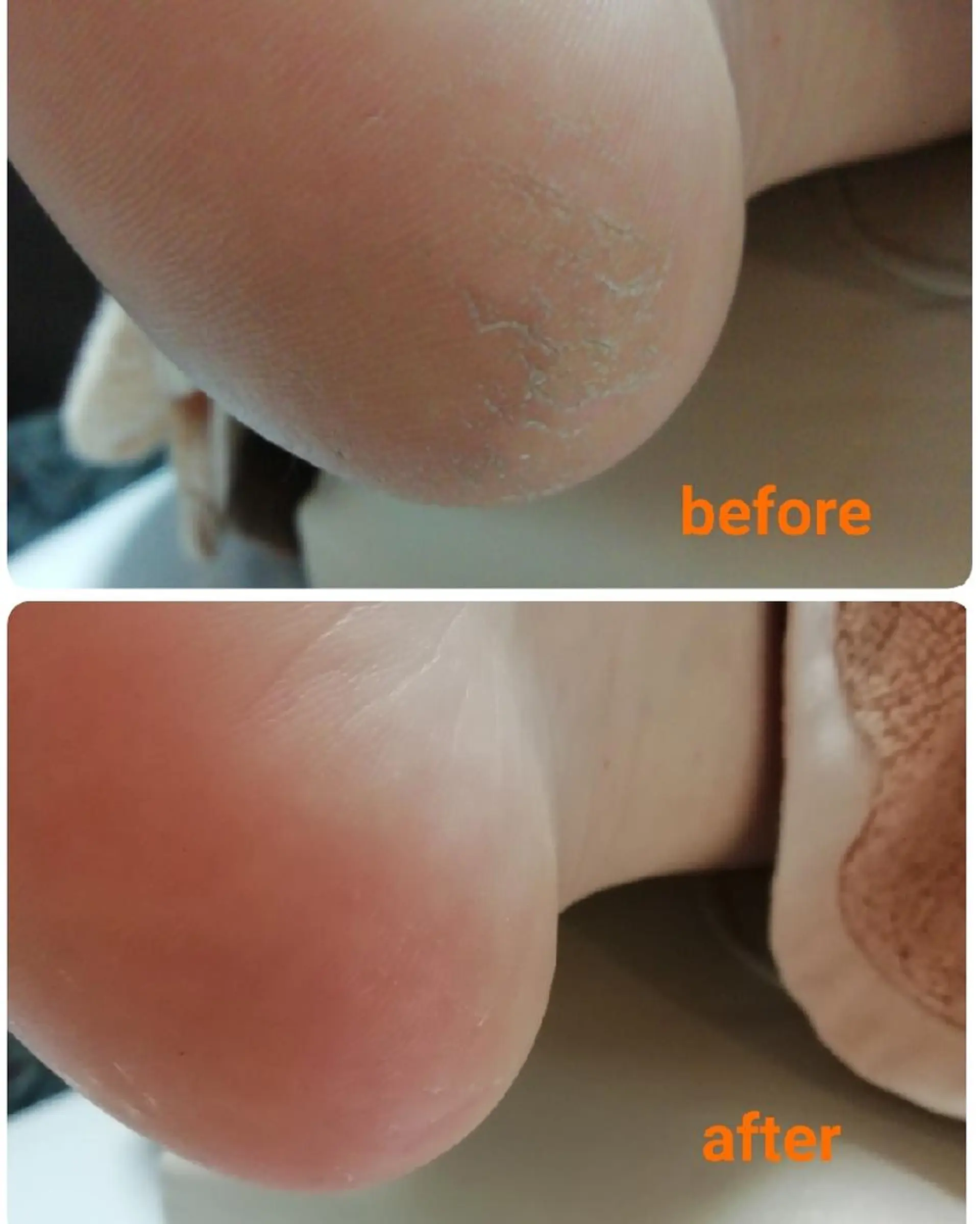 その他 巻き爪&フットケア レクーラのその他イメージ