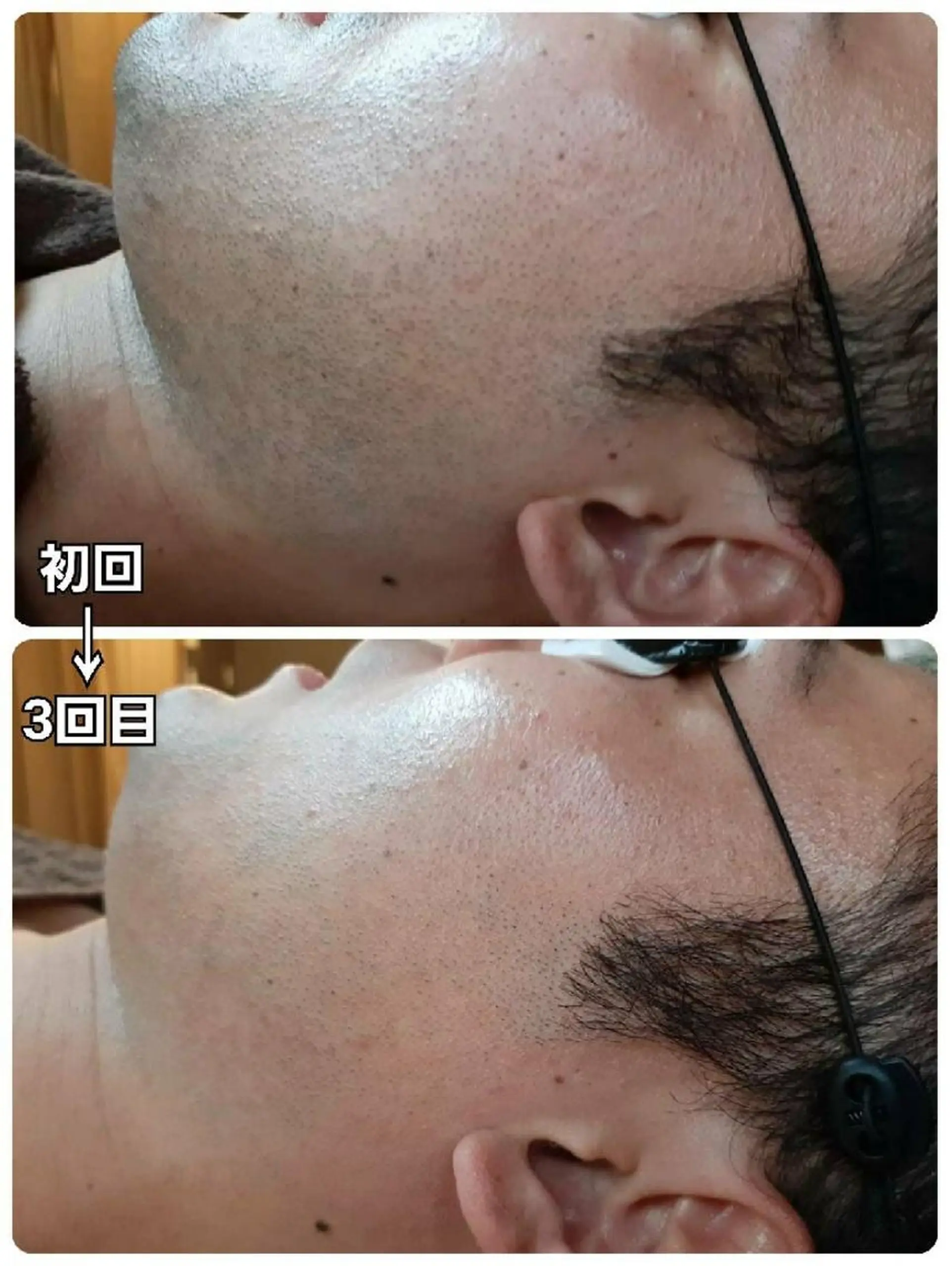 メンズ メンズ・脱毛サロン DEARS所属・山村幸久 メンズ脱毛 ディアーズのエステ・リラクイメージ