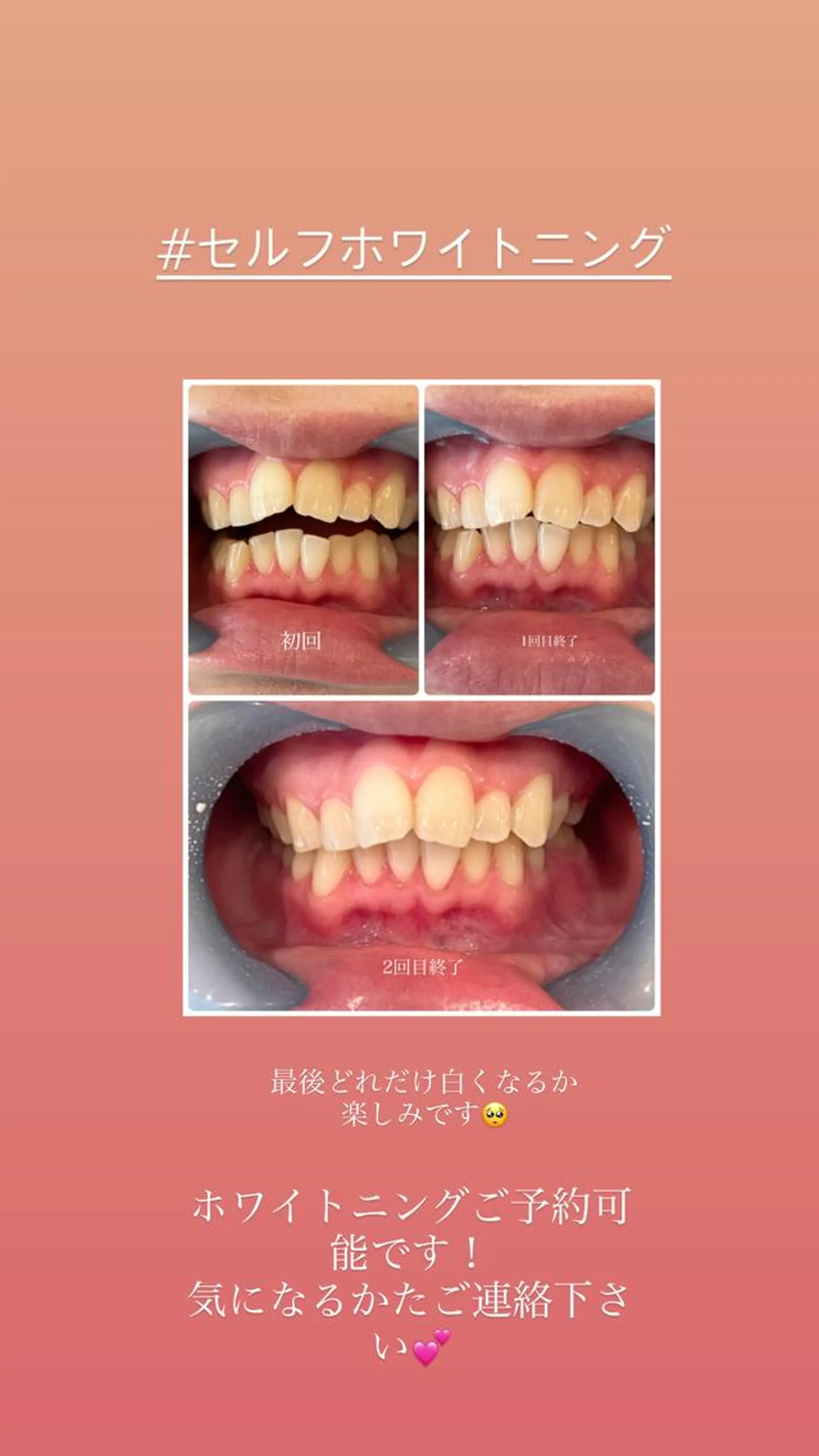 その他 Lune nailのネイルデザイン