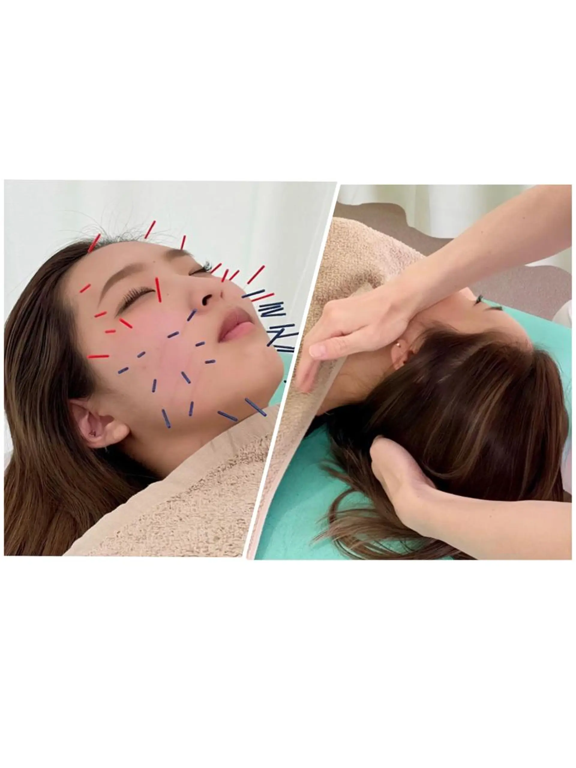 エステ リラク だいち 鍼灸院のエステ・リラクイメージ