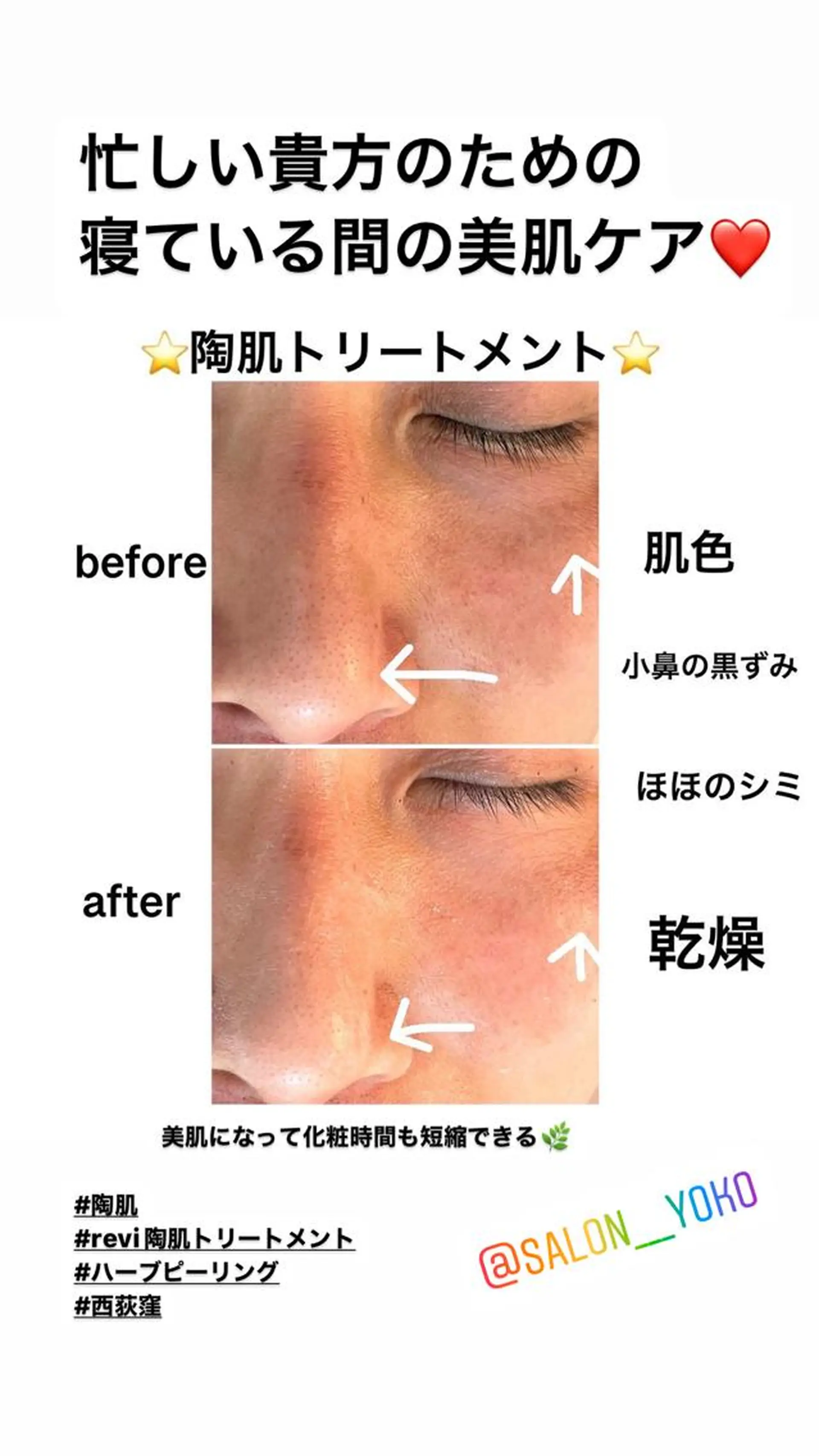 その他 アロマ•ピーリング SalonYokoのその他イメージ