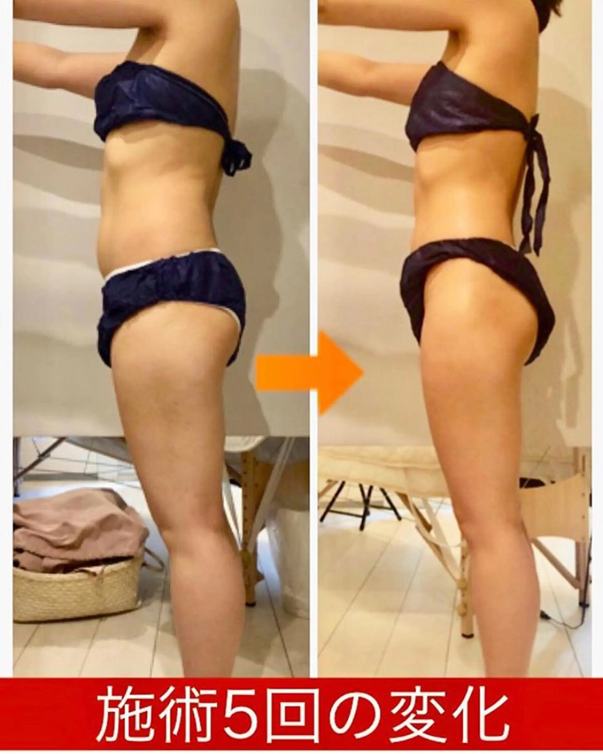 ショート カラー パーマ ヘアアレンジ メンズ キッズ ネイル マツエク・マツパ マットネイル 赤色 エステ リラク ‍痩身＆ボディ 結果出し🌟丹野のエステ・リラクイメージ