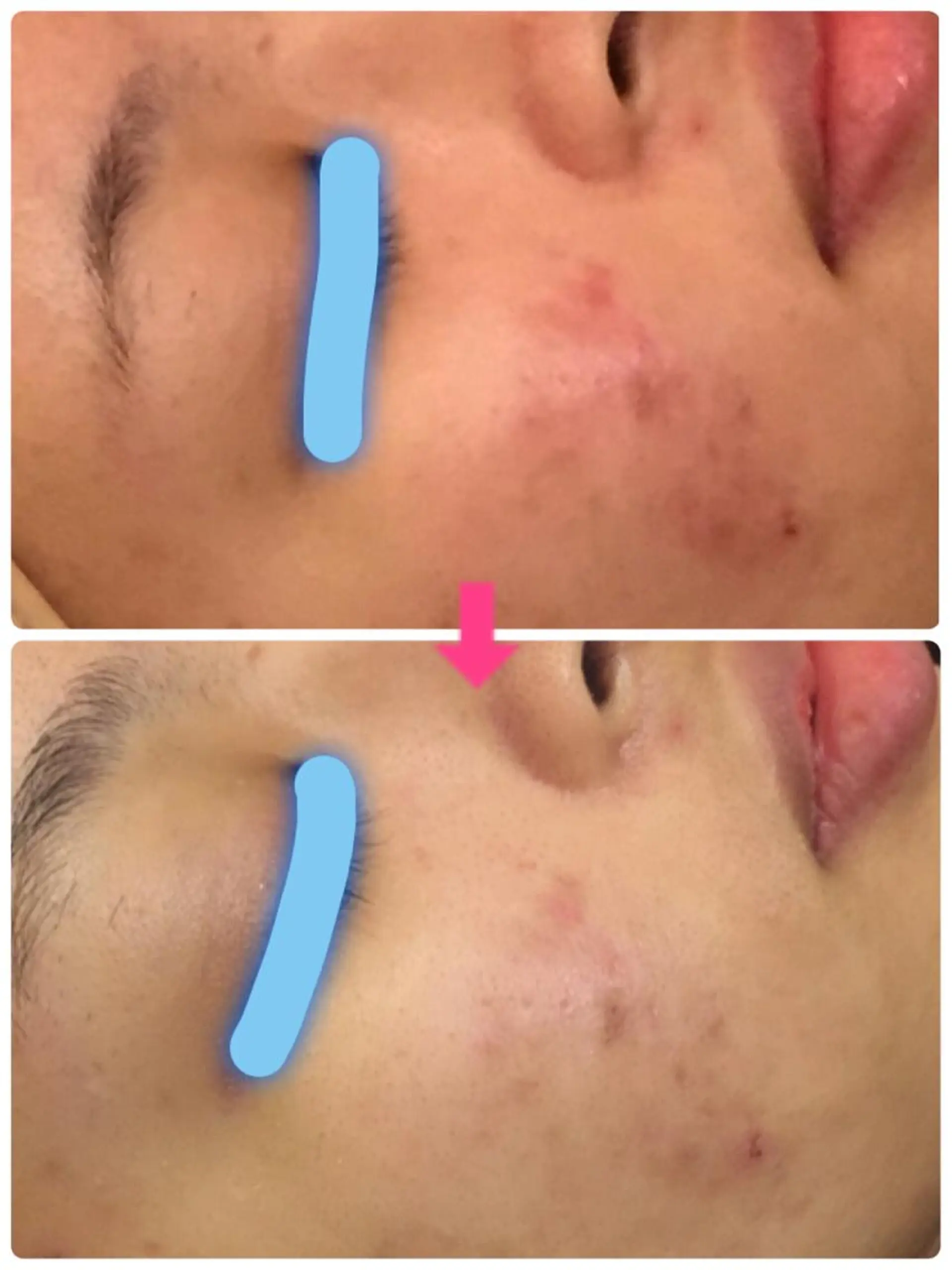 ショート カラー パーマ ヘアアレンジ メンズ キッズ ネイル マツエク・マツパ ‍痩身＆ボディ 結果出し🌟丹野のエステ・リラクイメージ