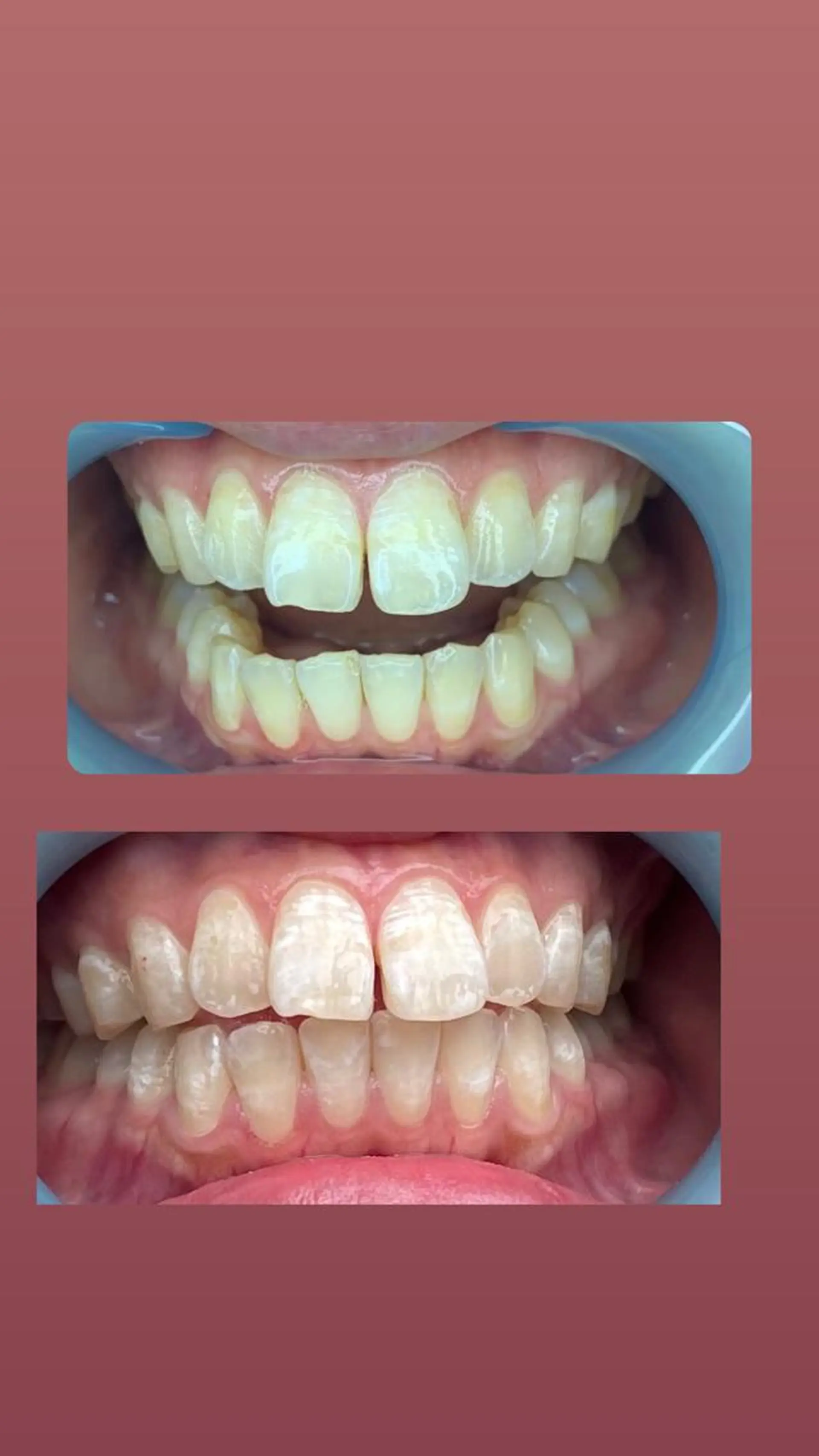 LAVISH nail salonのヘアスタイル