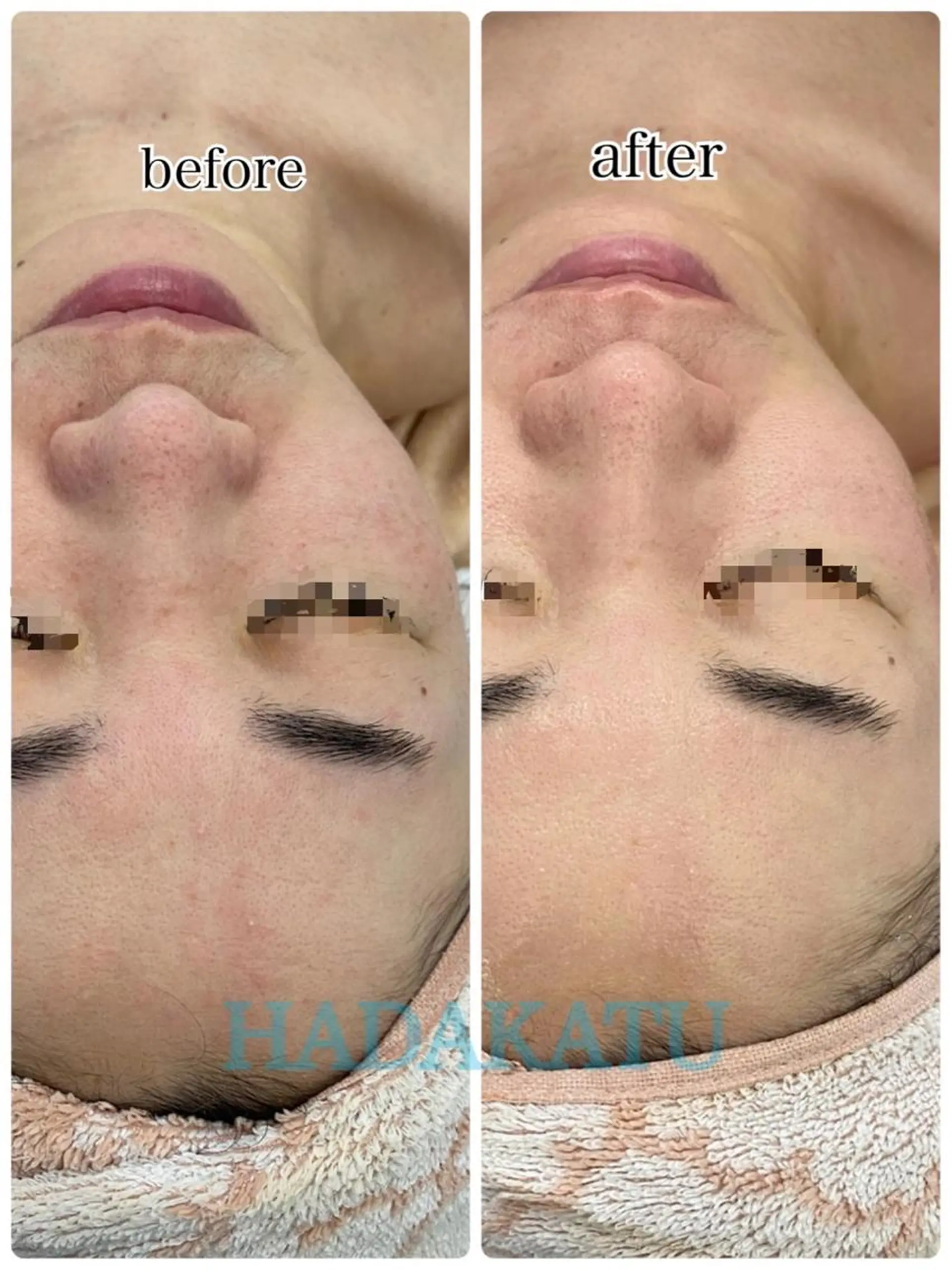 総合エステサロン 肌活のエステ・リラクイメージ