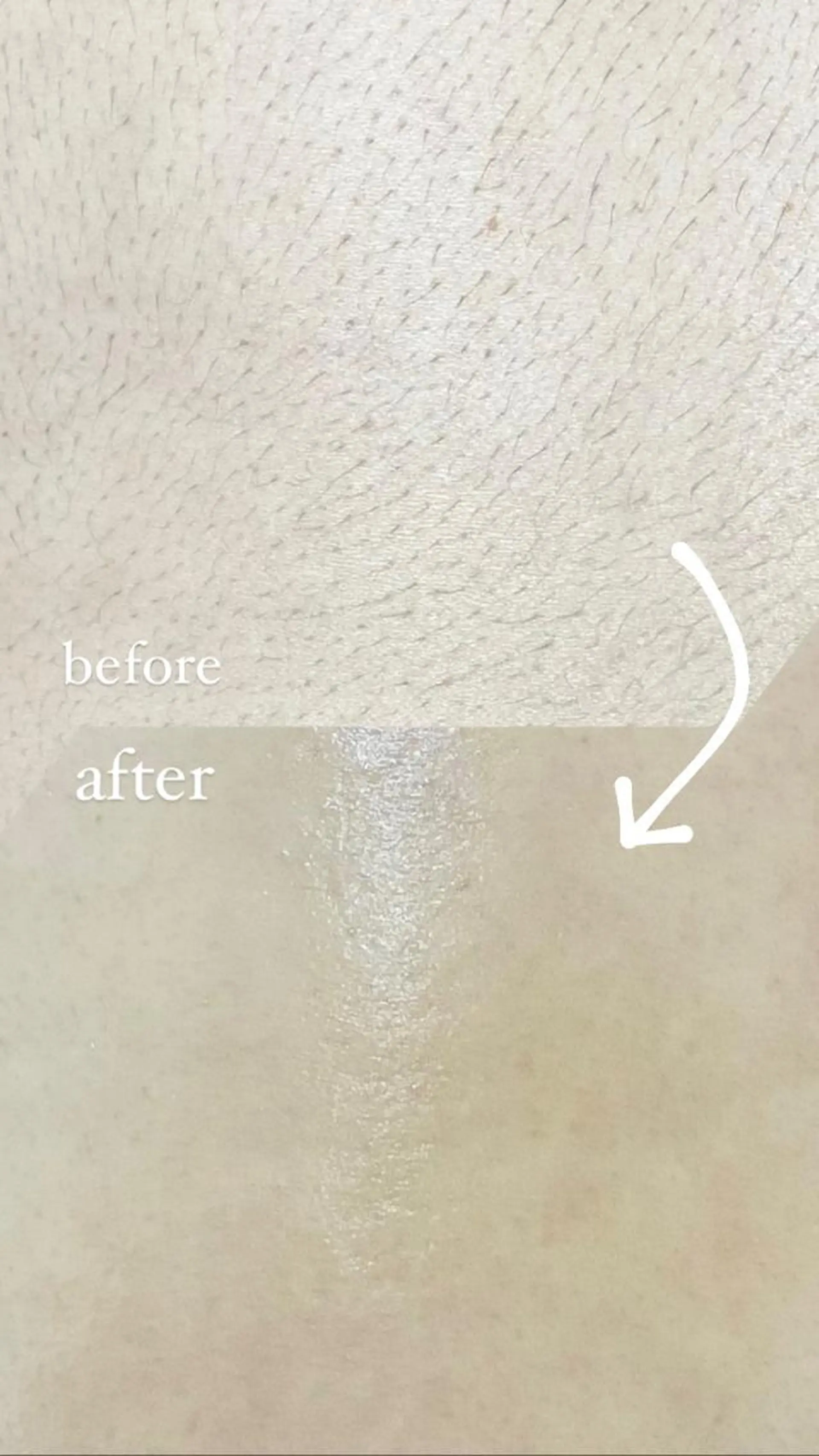 脱毛 &me ayakaのエステ・リラクイメージ