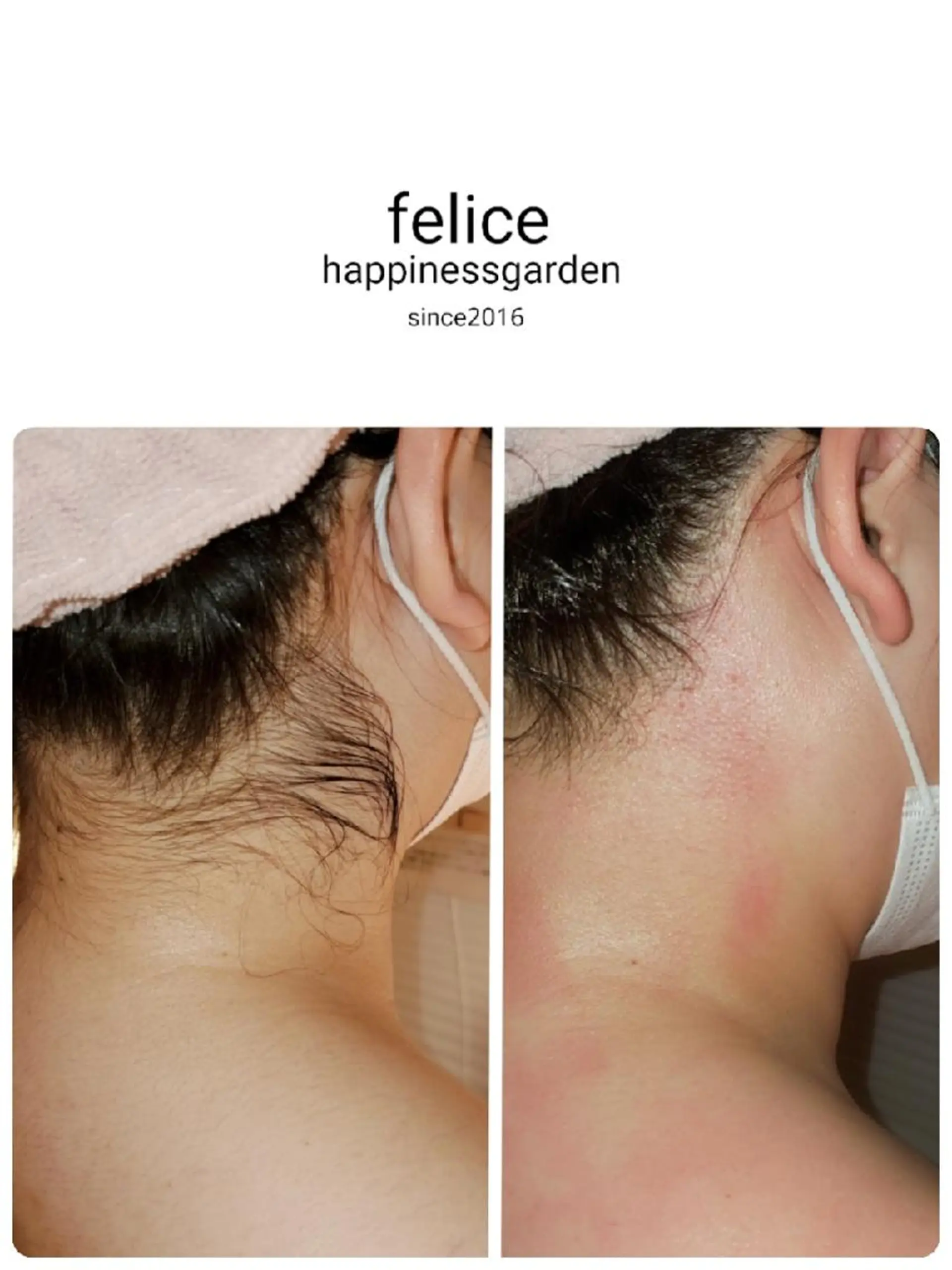 脱毛 beauty salon felice所属・フェリーチェ 心斎橋のエステ・リラクイメージ