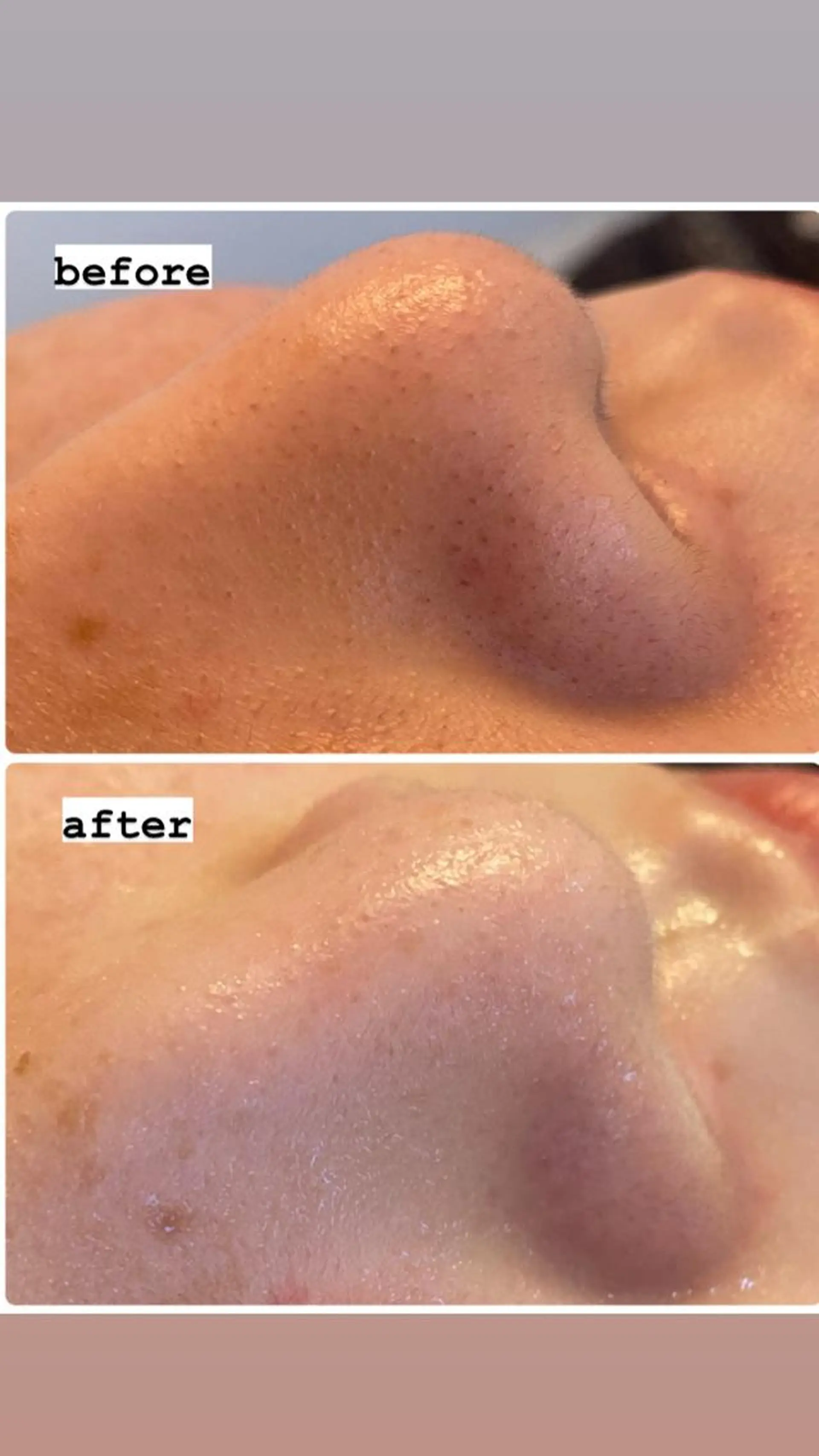 脱毛・エステサロン LuLuNのエステ・リラクイメージ