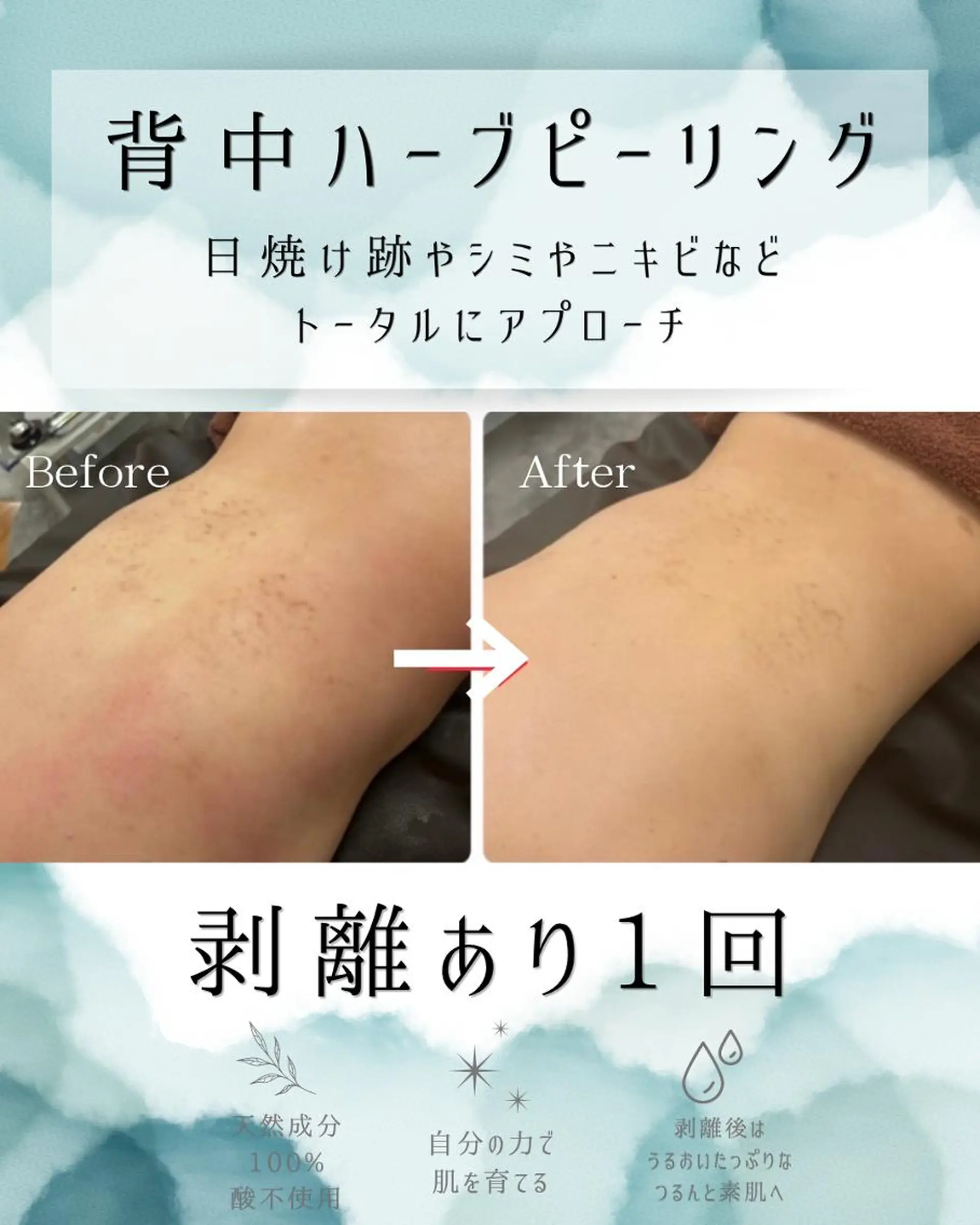 エステ リラク 医療提携 肌管理痩身エステ池袋のエステ・リラクイメージ