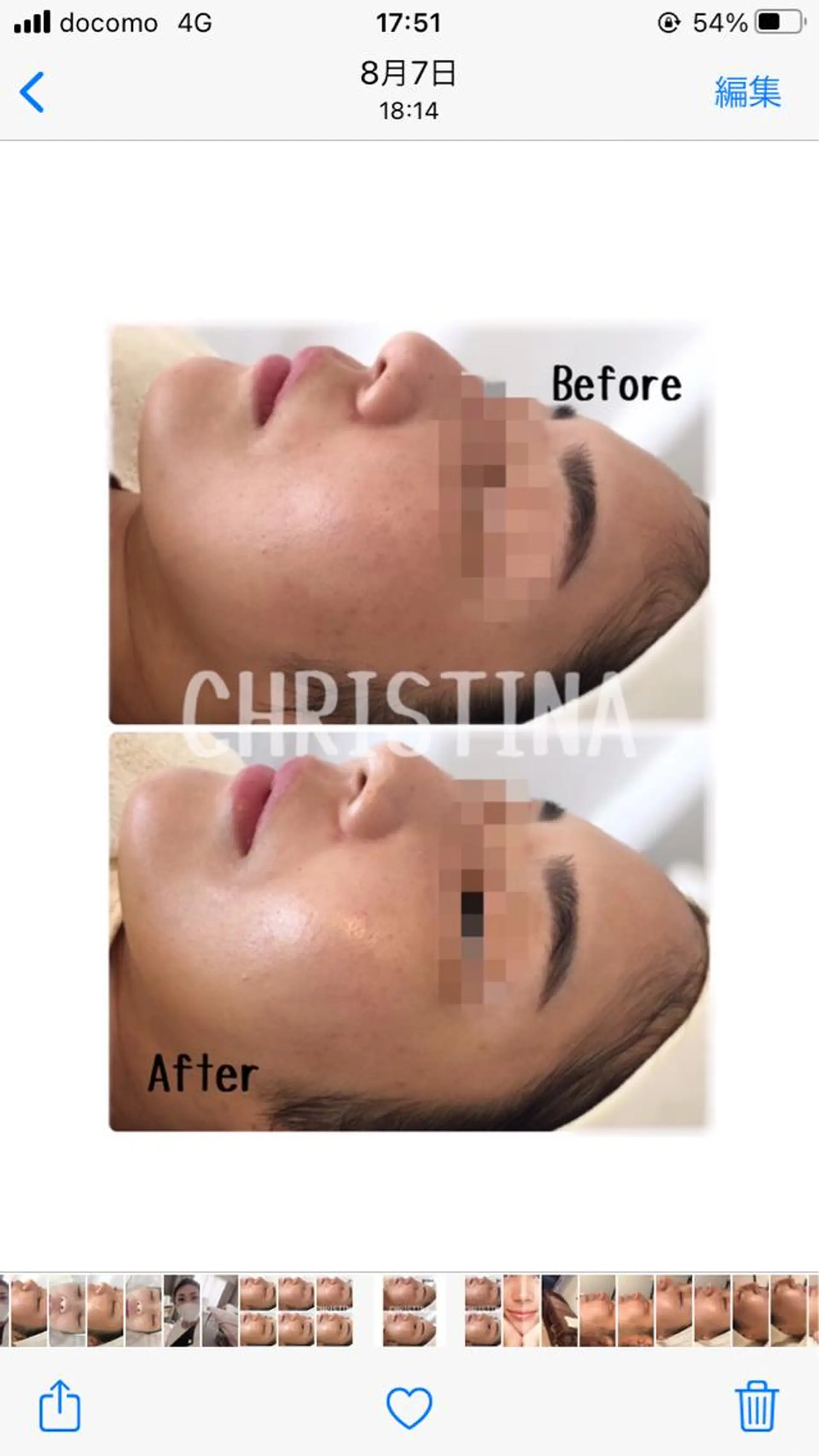 肌質改善サロン chouchouのエステ・リラクイメージ