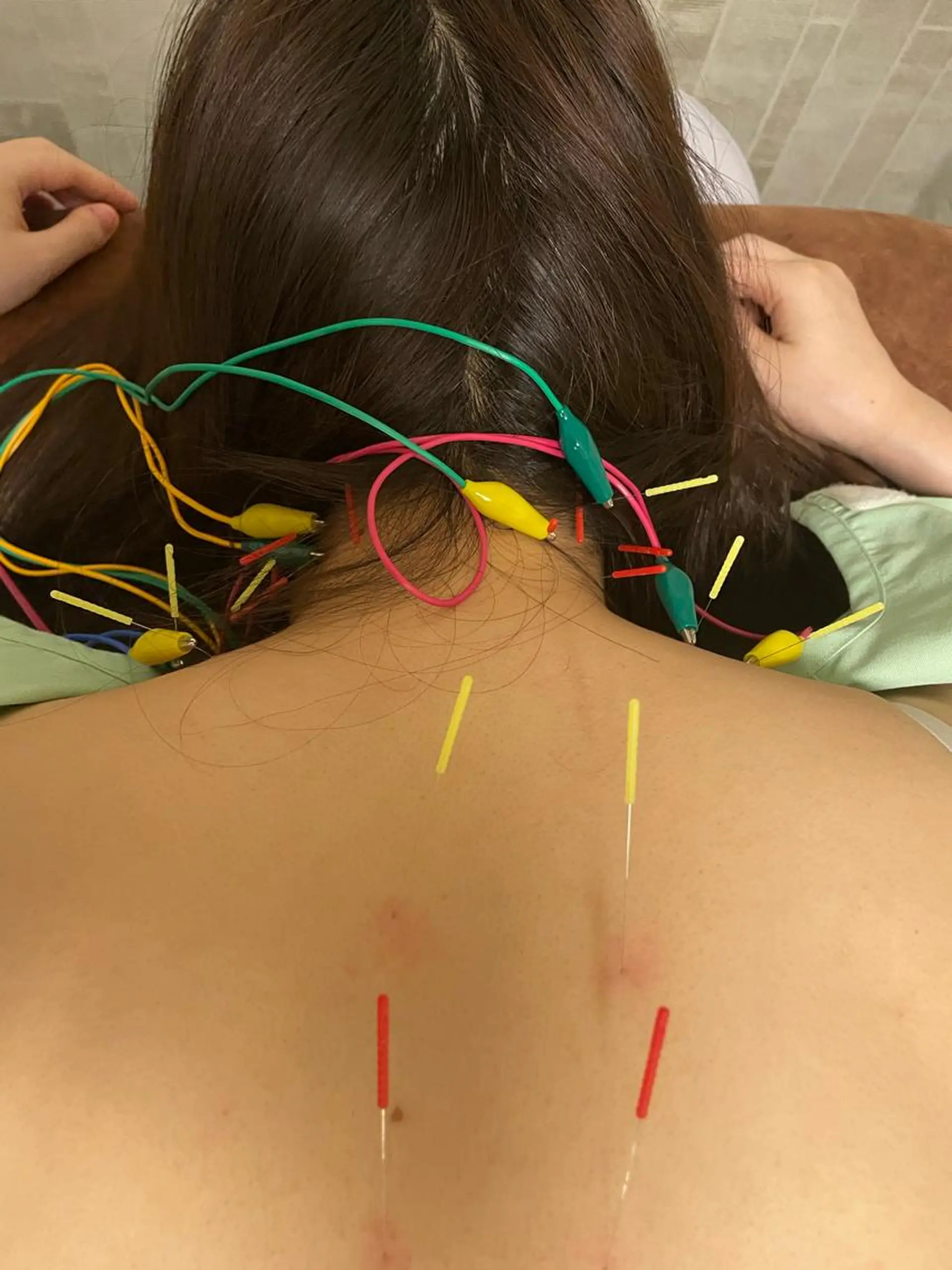 エステ リラク 美容鍼灸サロン mahoroba院長のエステ・リラクイメージ